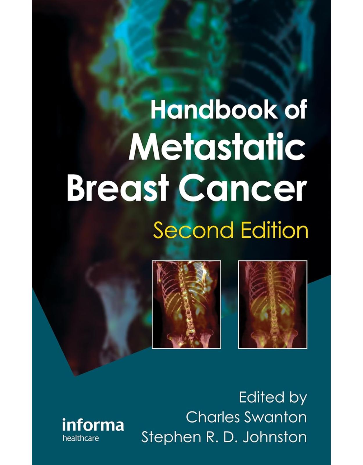 Handbook of Metastatic Breast Cancer