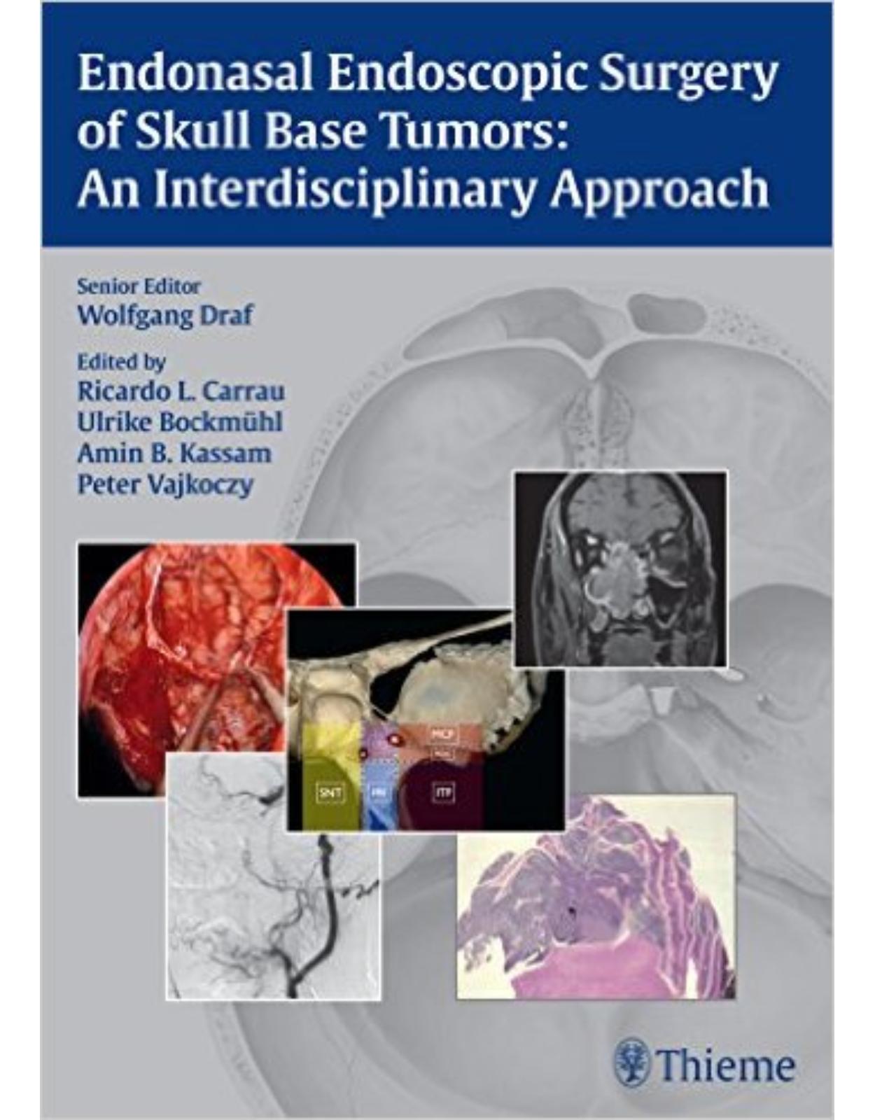 Endonasal Endoscopic Surgery of Skull Base Tumors: An Interdisciplinary Approach 1st edition Edition