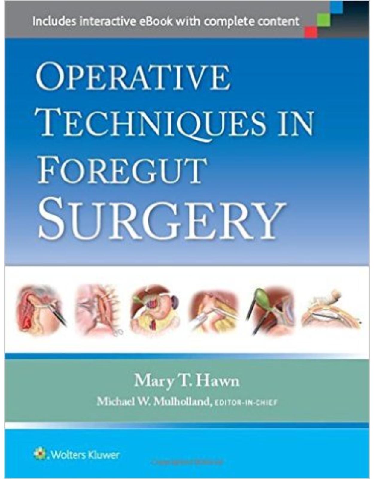 Operative Techniques in Foregut Surgery First Edition