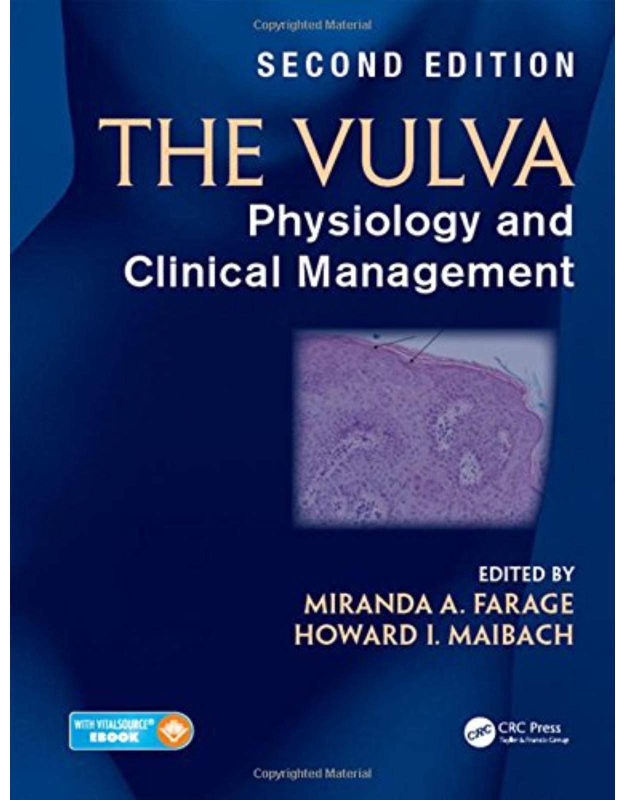 The Vulva: Physiology and Clinical Management: Physiology and Clinical Management, Second Edition