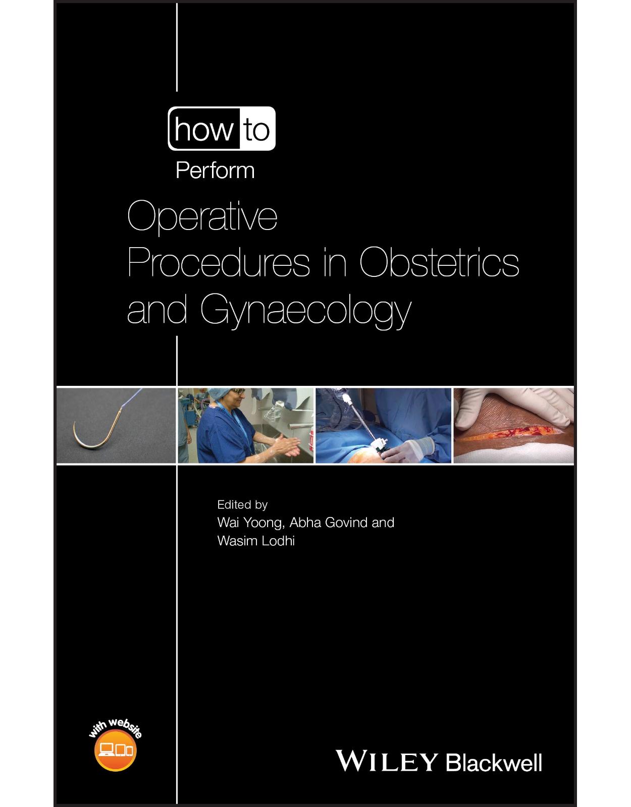 How to Perform Operative Procedures in Obstetrics and Gynaecology