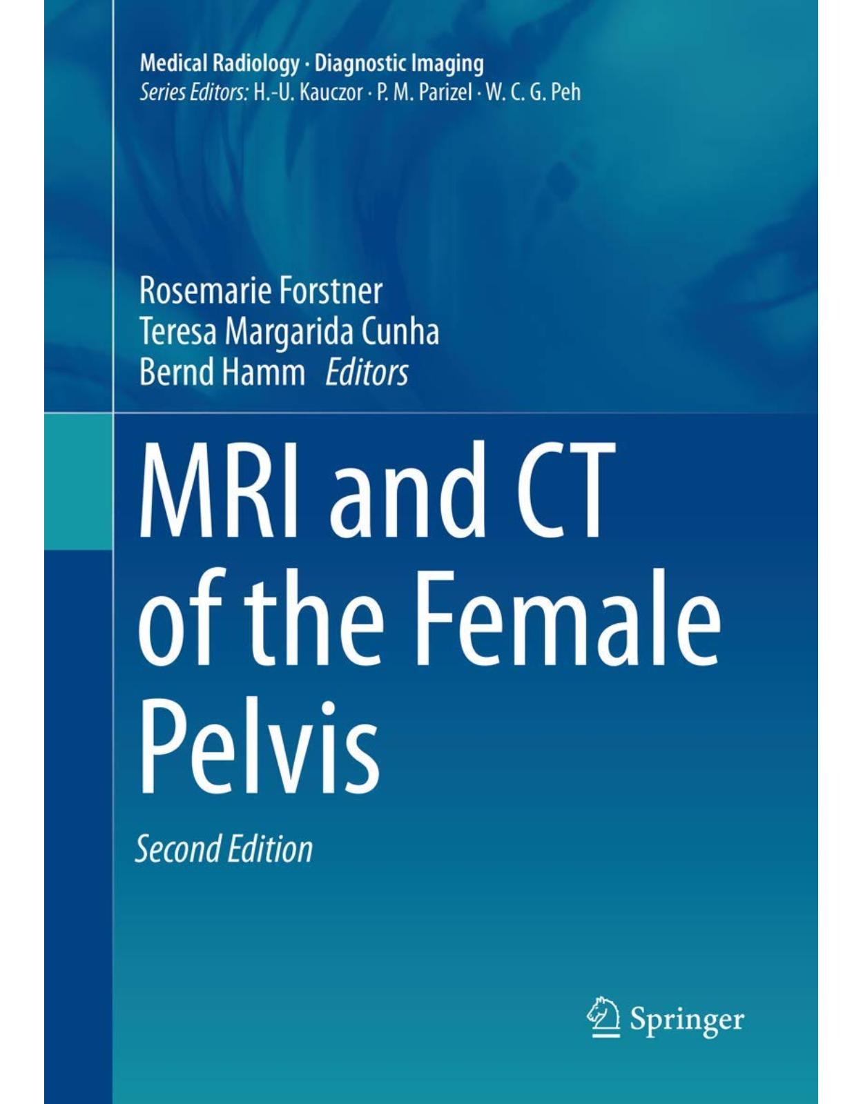 MRI and CT of the Female Pelvis 
