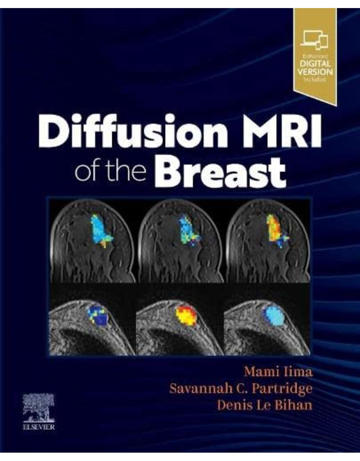 Diffusion MRI of the Breast