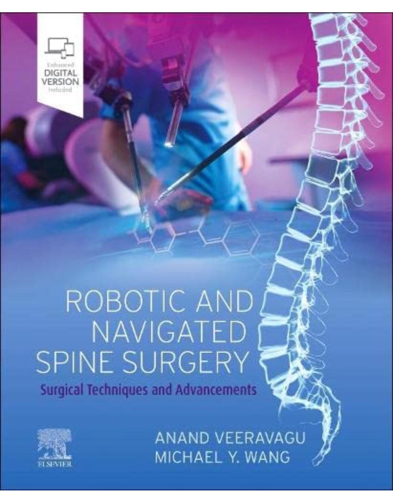 Robotic and Navigated Spine Surgery: Surgical Techniques and Advancements