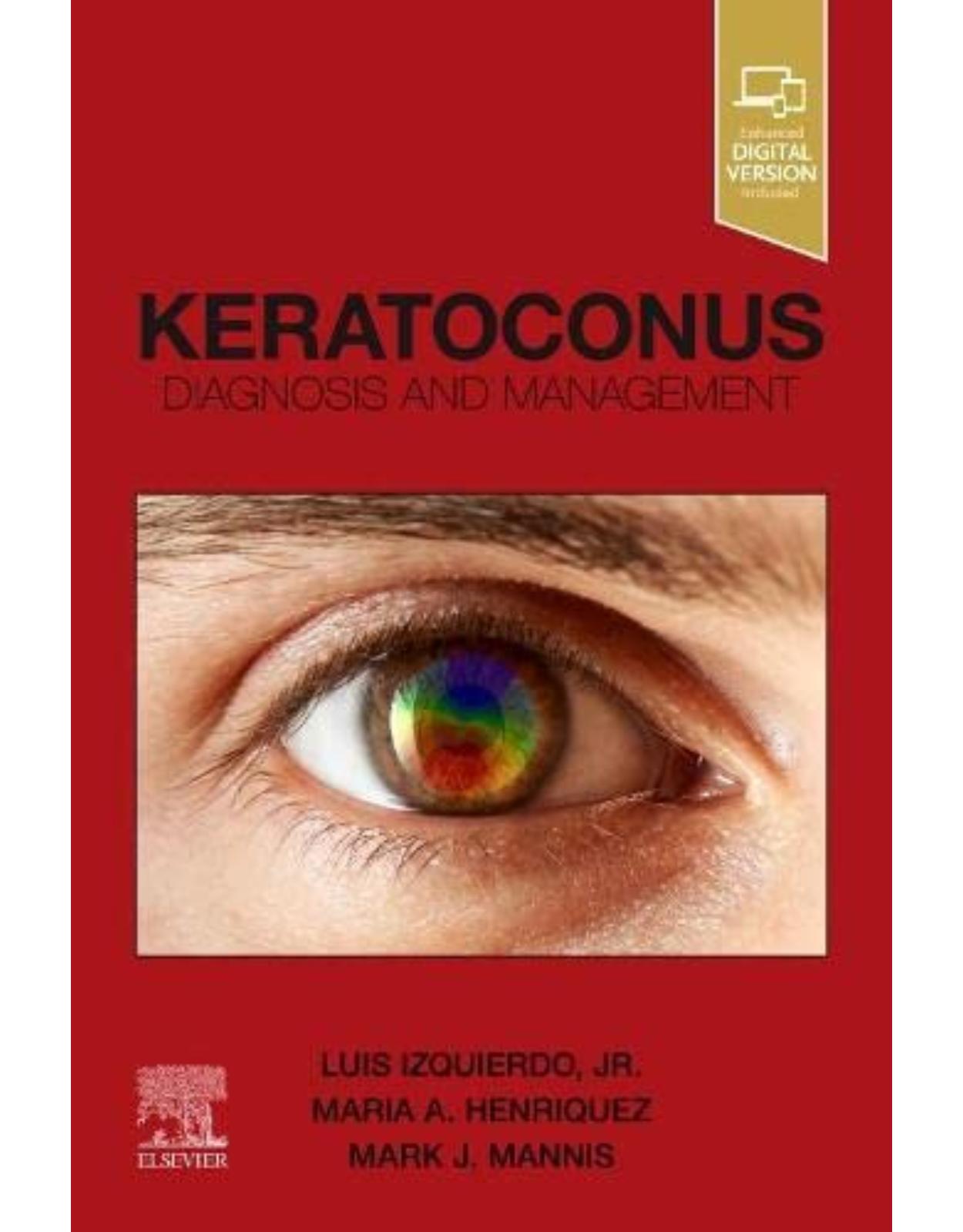 Keratoconus: Diagnosis and Management 