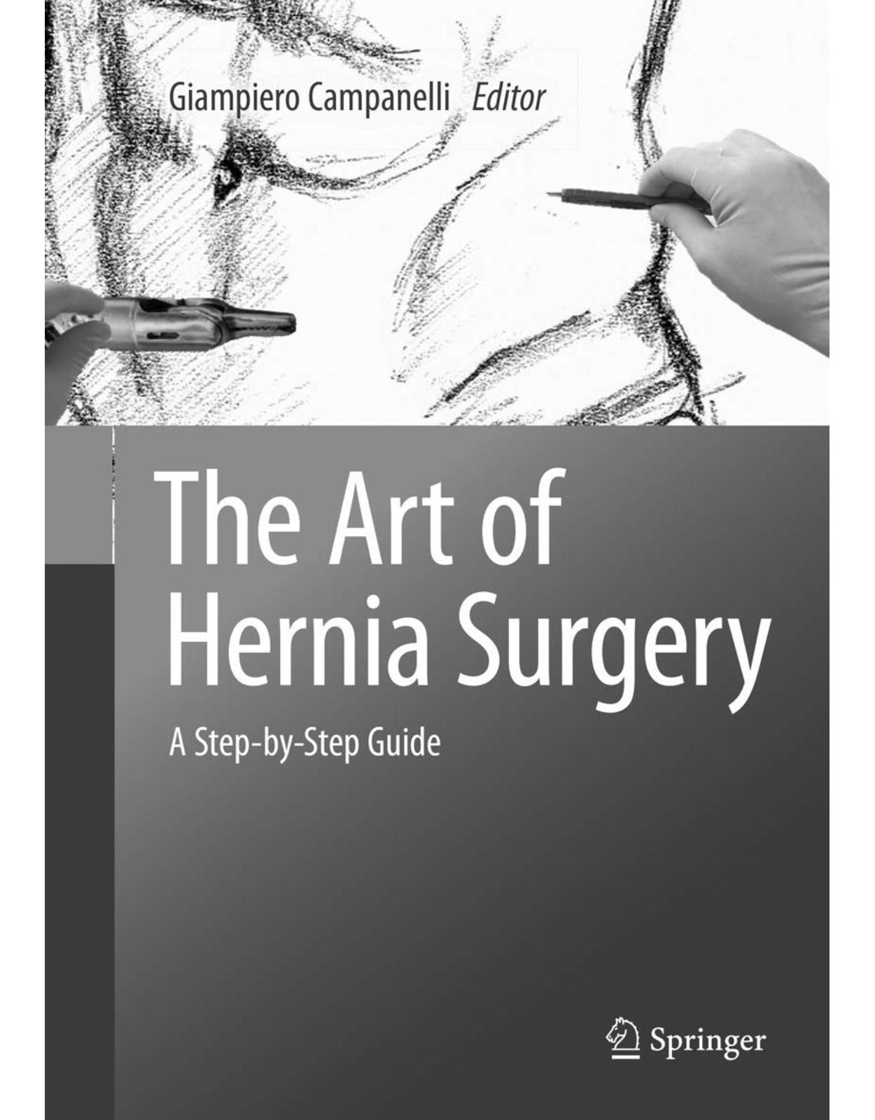 The Art of Hernia Surgery: A Step-by-Step Guide
