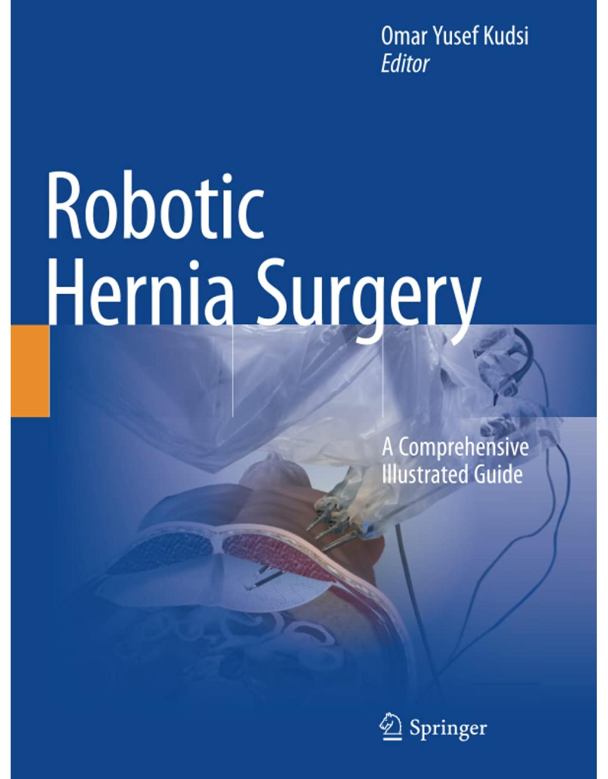 Robotic Hernia Surgery: A Comprehensive Illustrated Guide