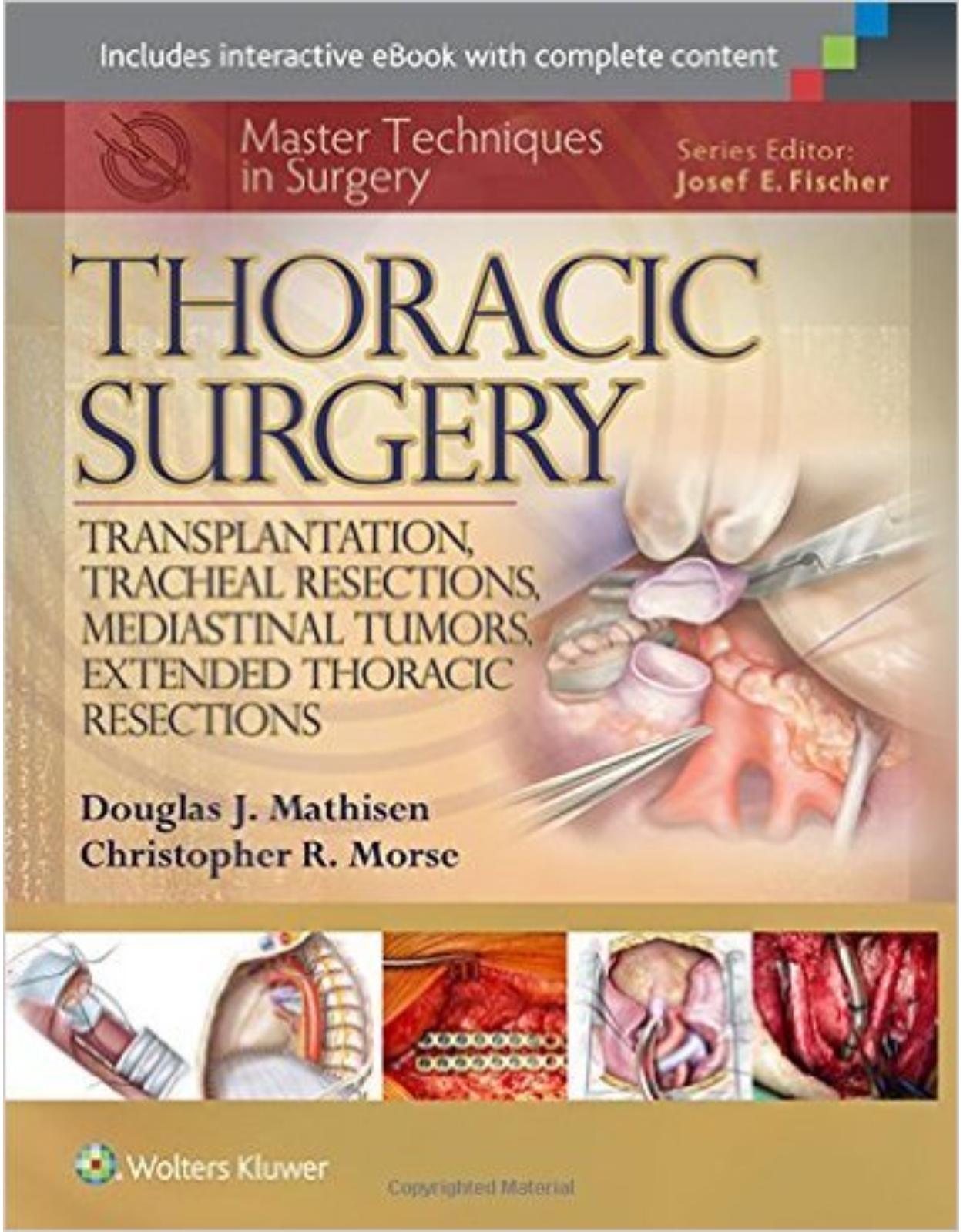 Master Techniques in Surgery: Thoracic Surgery: Transplantation, Tracheal Resections, Mediastinal Tumors, Extended Thoracic Resections First Edition