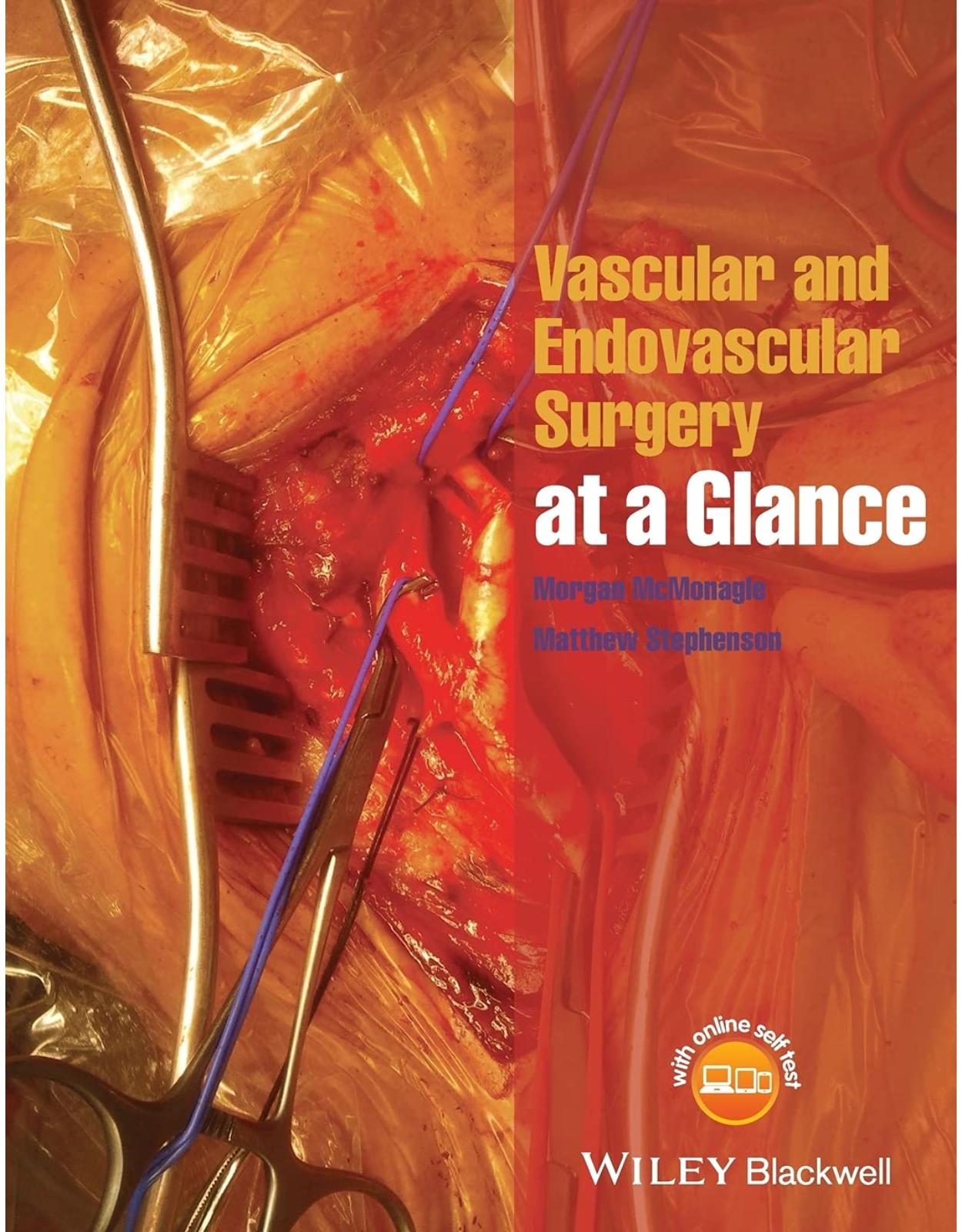 Vascular and Endovascular Surgery at a Glance 