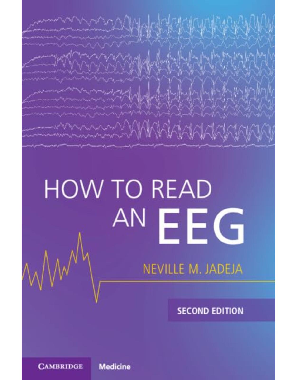 How to Read an EEG, 2nd Edition