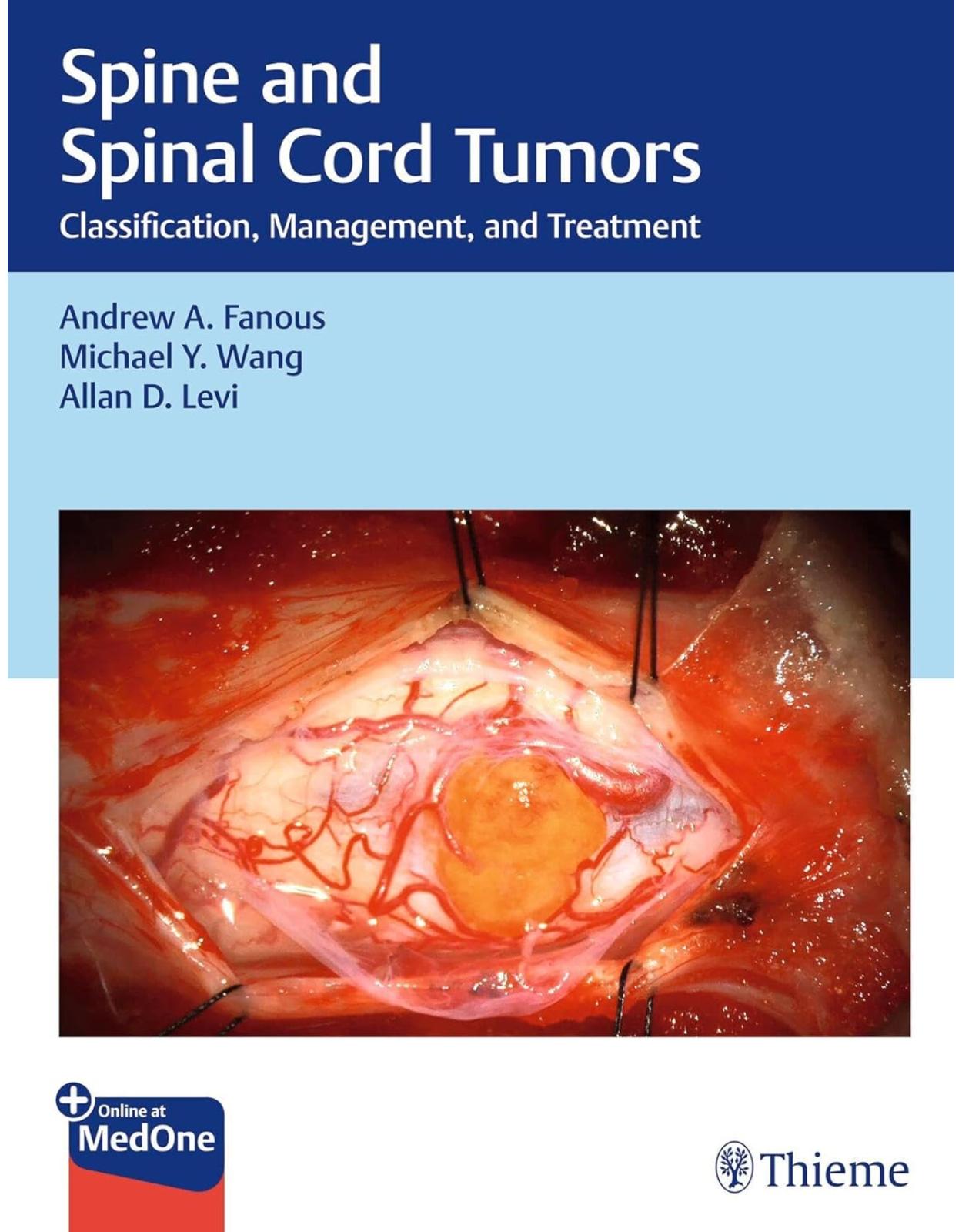 Spine and Spinal Cord Tumors. Classification, Management, and Treatment