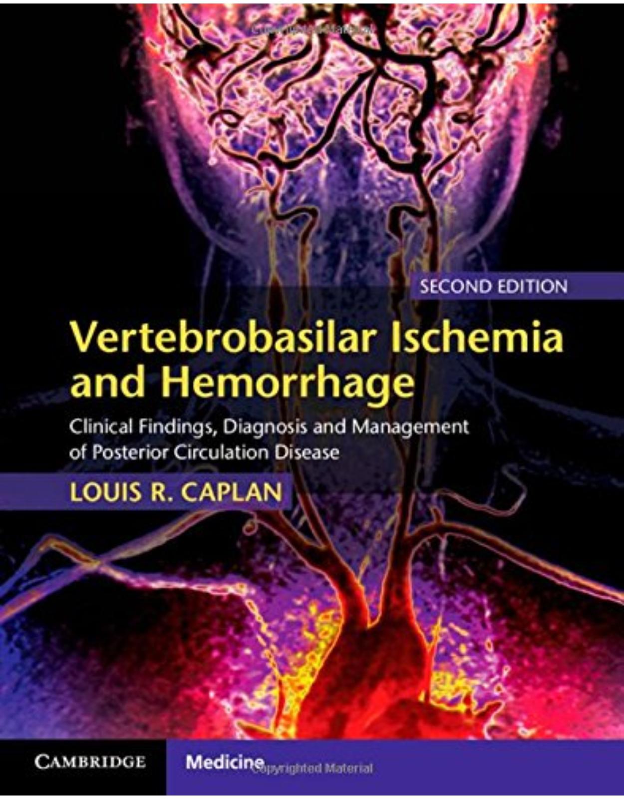 Vertebrobasilar Ischemia and Hemorrhage