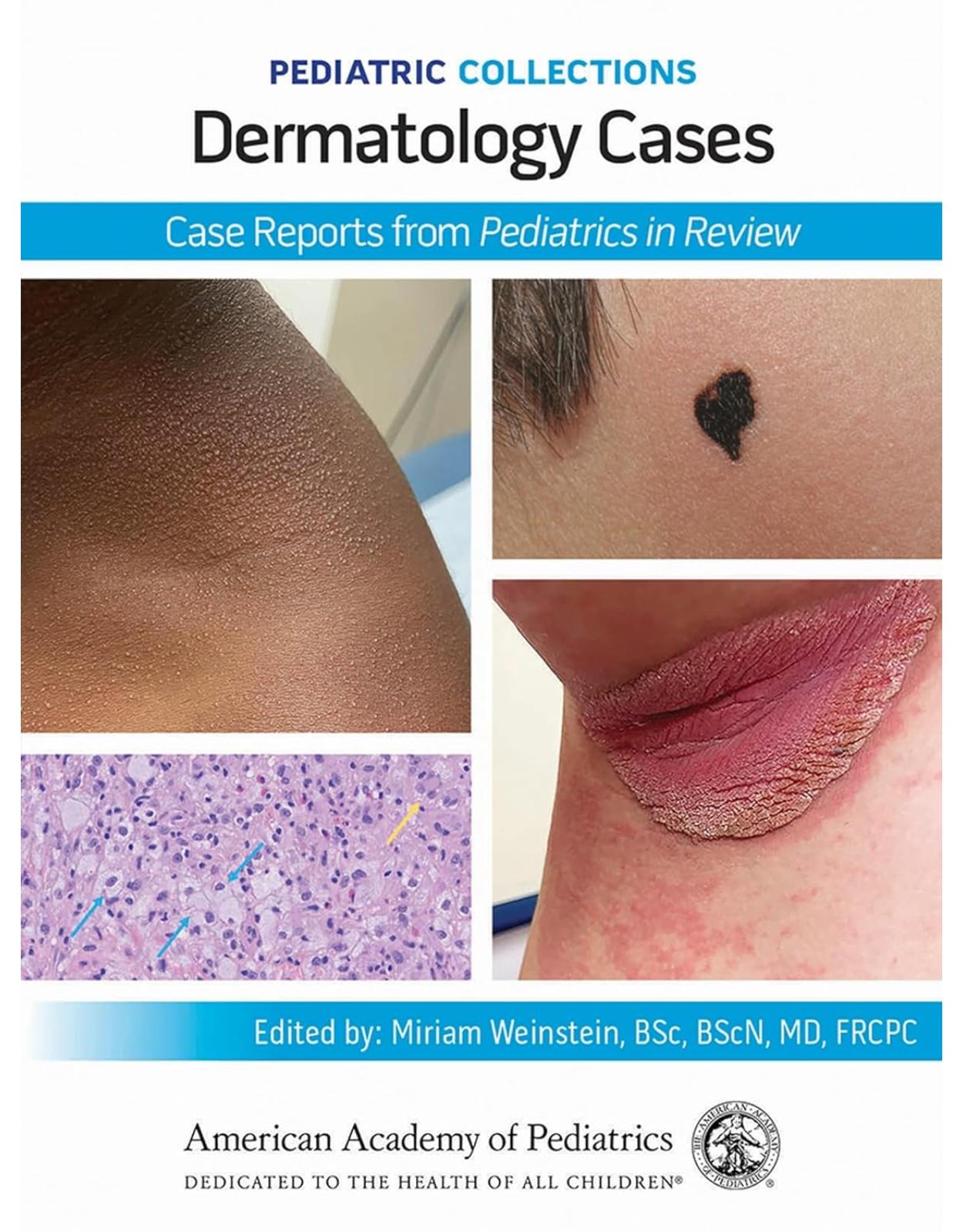 Pediatric Collections: Dermatology Cases