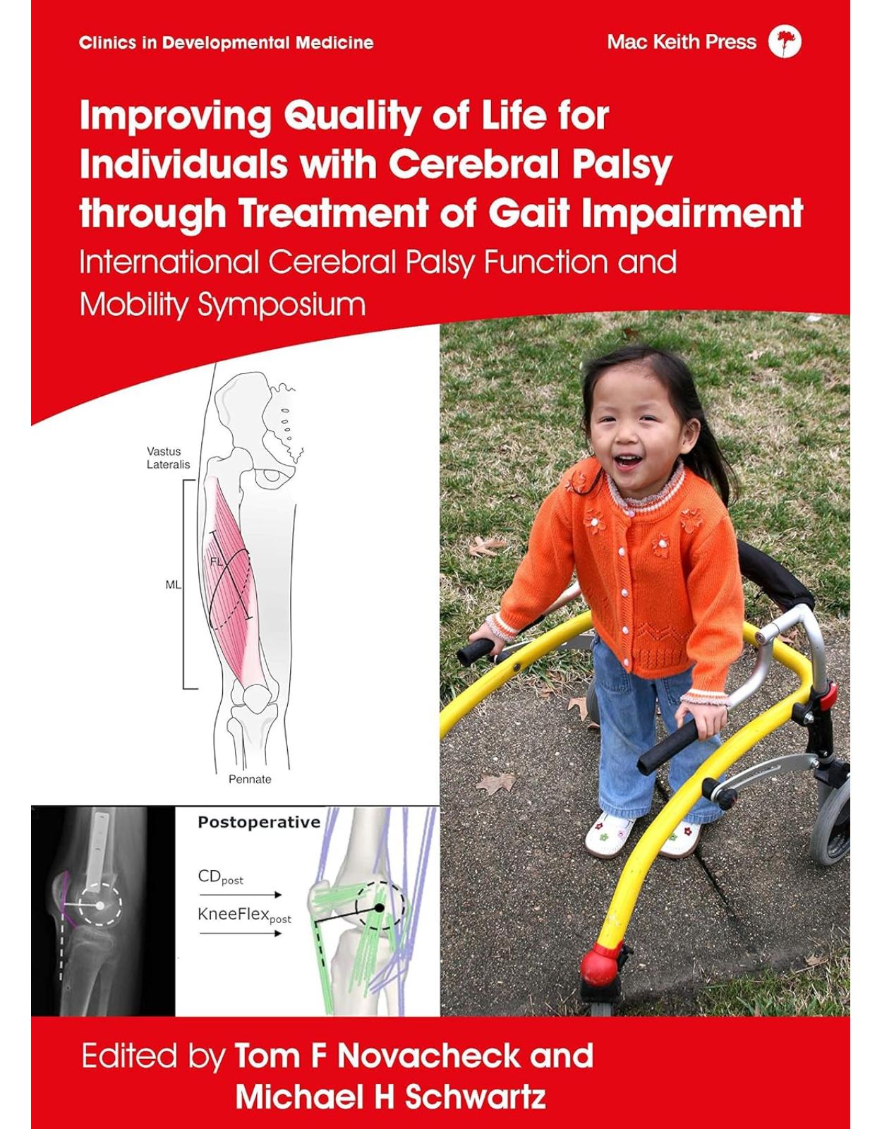 Improving Quality of Life for Individuals with Cerebral Palsy through Treatment of Gait Impairment: International Cerebral Palsy Function and Mobility