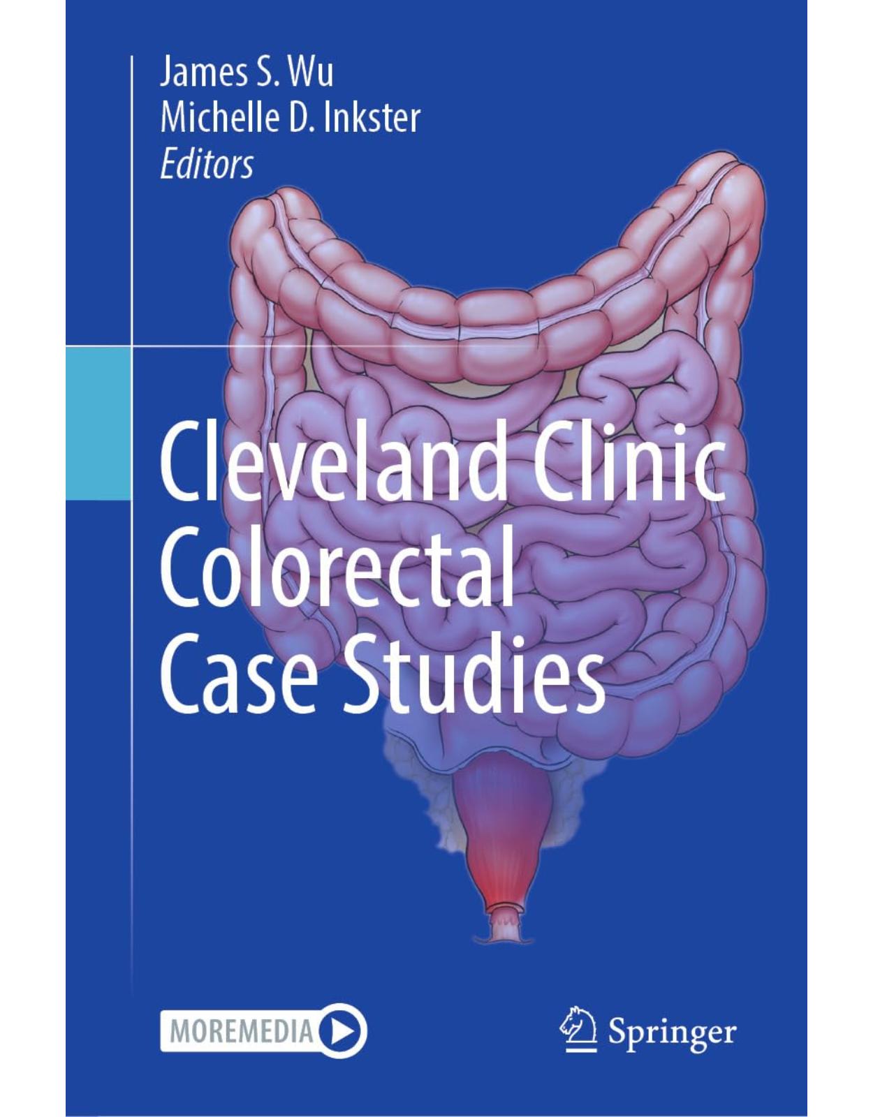 Cleveland Clinic Colorectal Case Studies