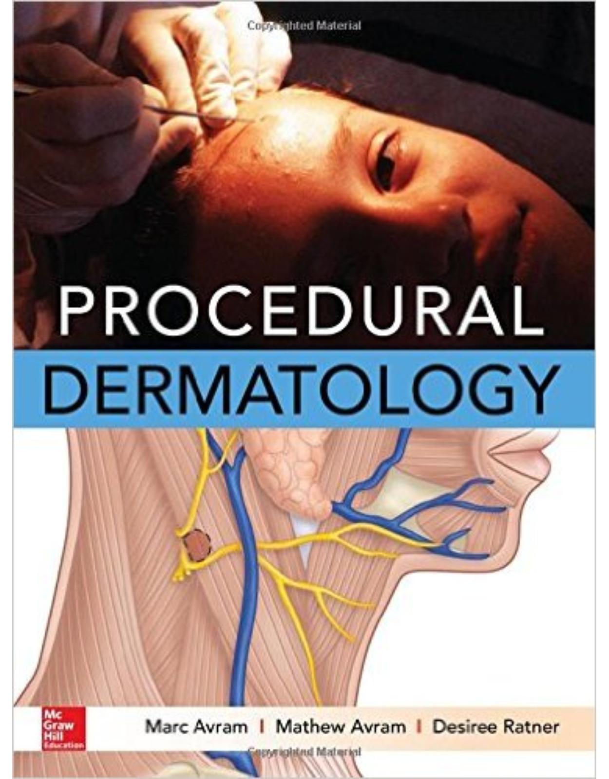 Procedural Dermatology 1st Edition