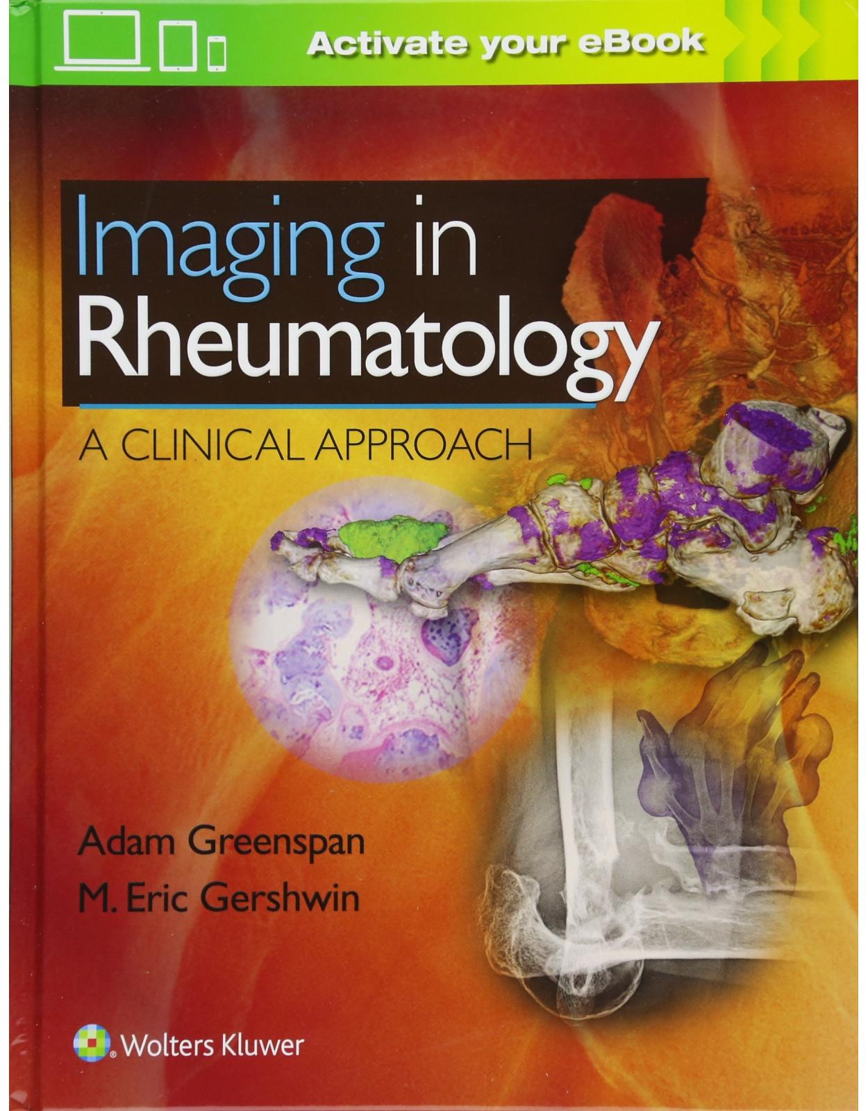 Imaging in Rheumatology: A Clinical Approach