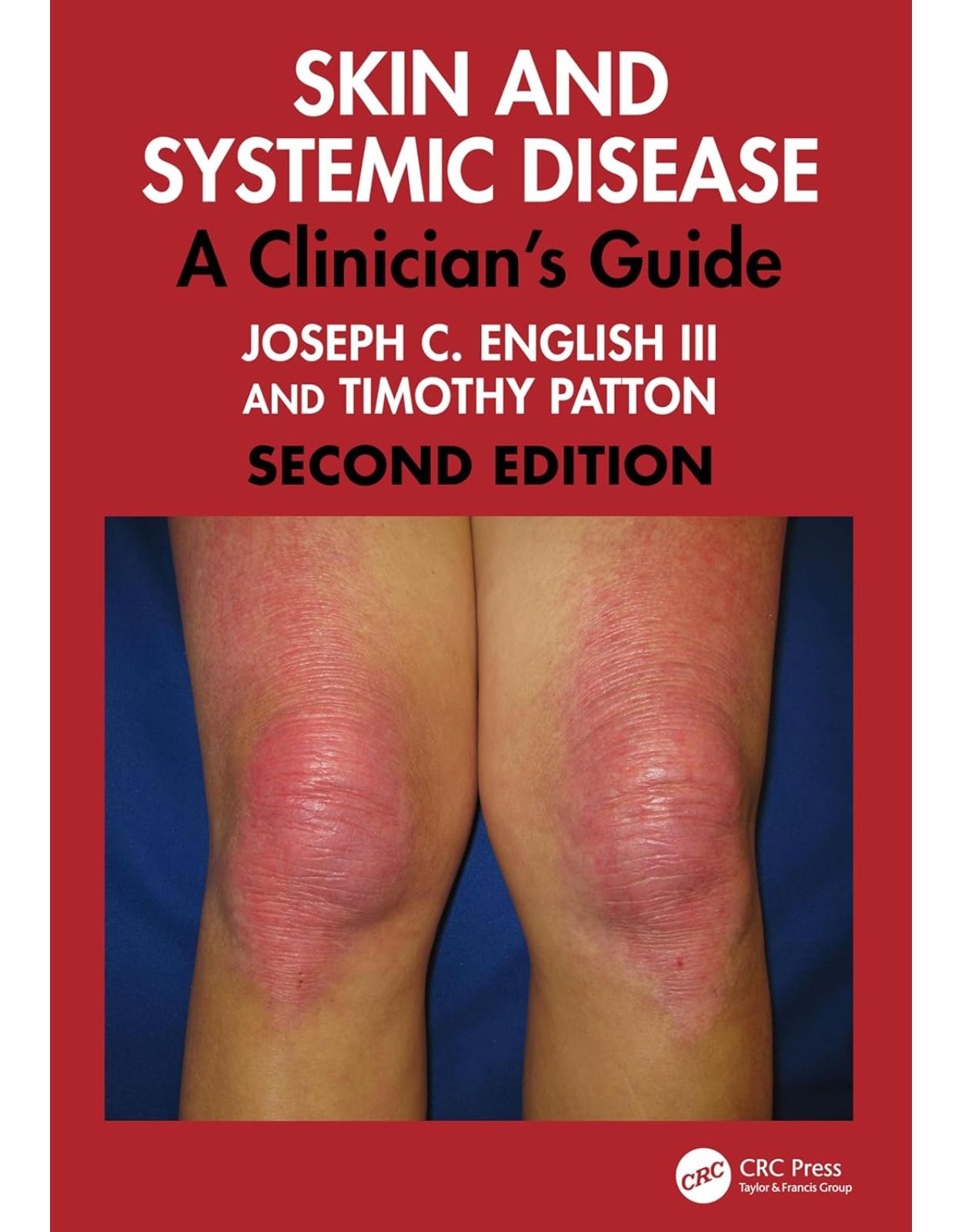 Skin and Systemic Disease. A Clinician's Guide