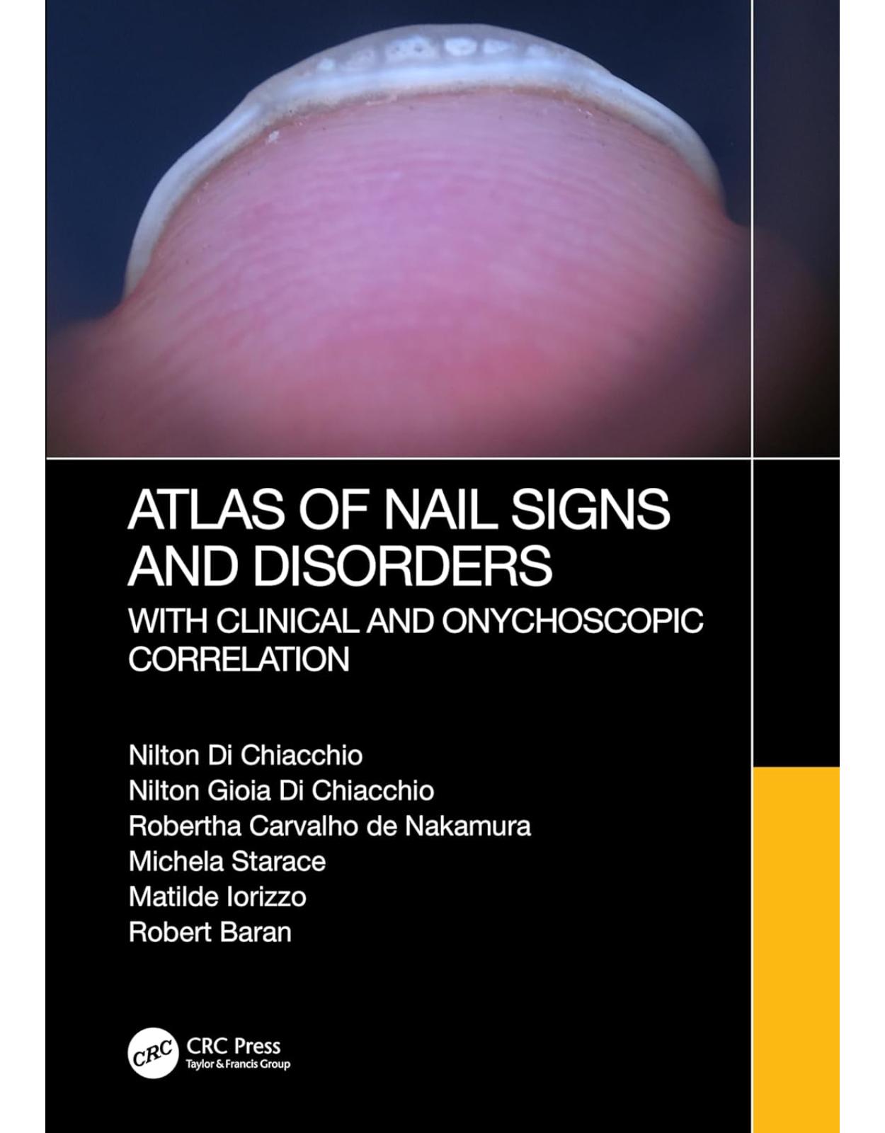 Atlas of Nail Signs and Disorders with Clinical and Onychoscopic Correlation