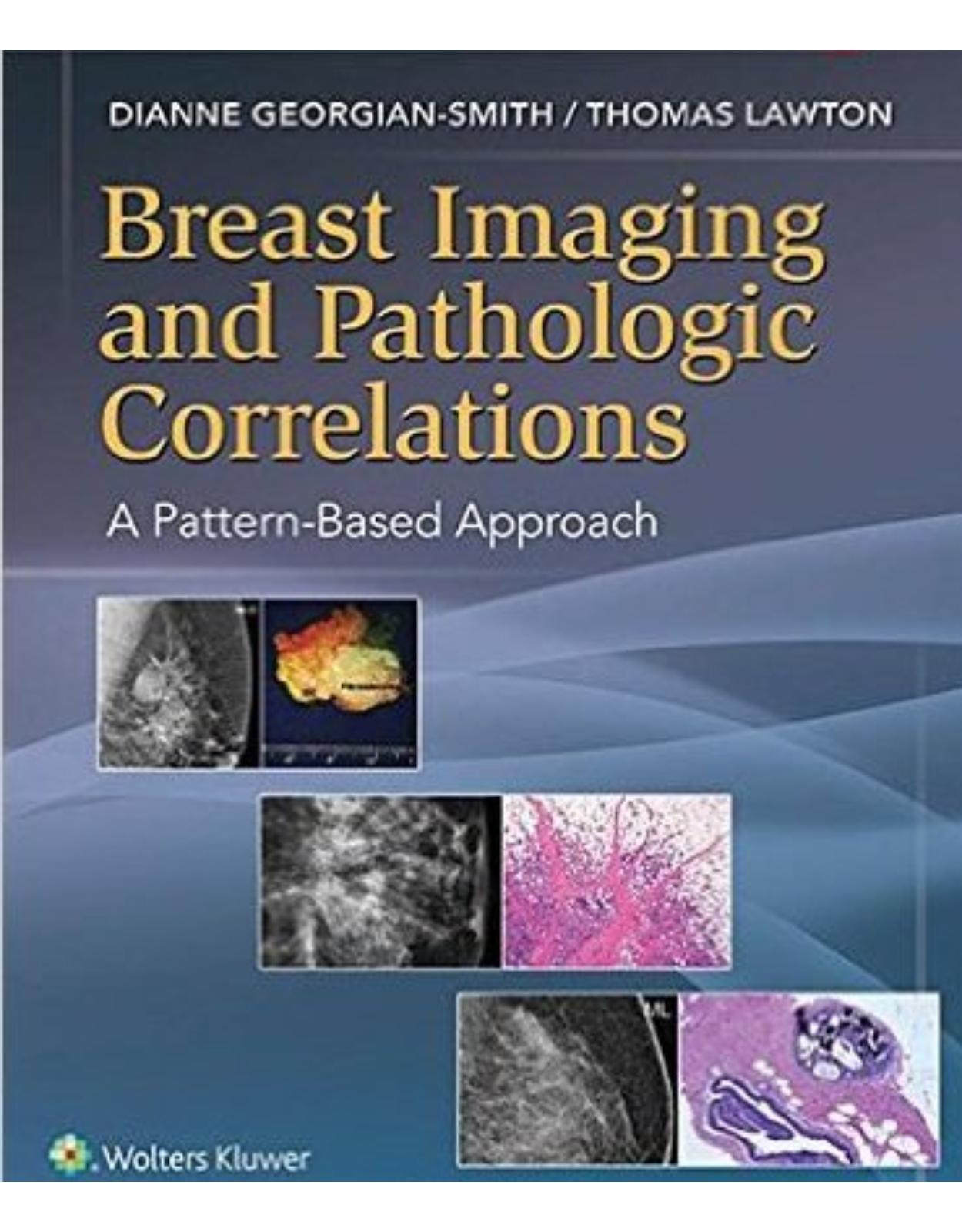 Breast Imaging and Pathologic Correlations: A Pattern-Based Approach First Edition