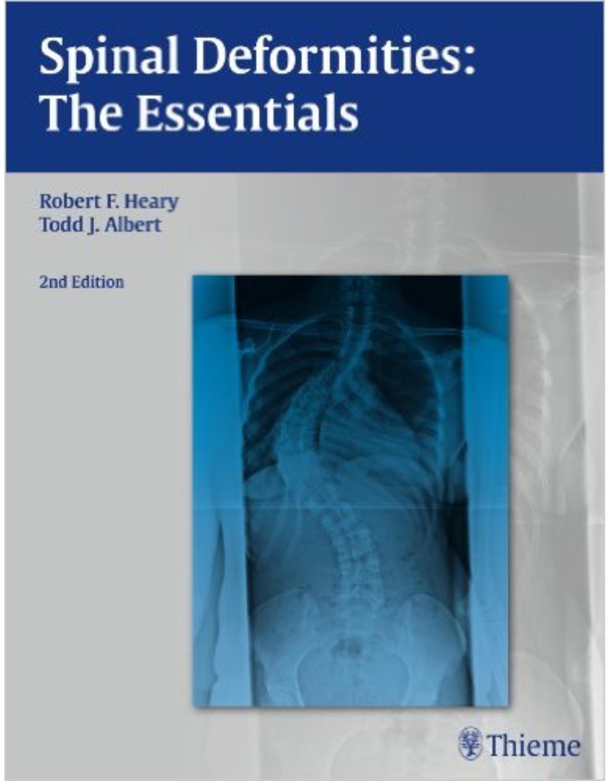 Spinal Deformities: The Essentials 2nd edition 