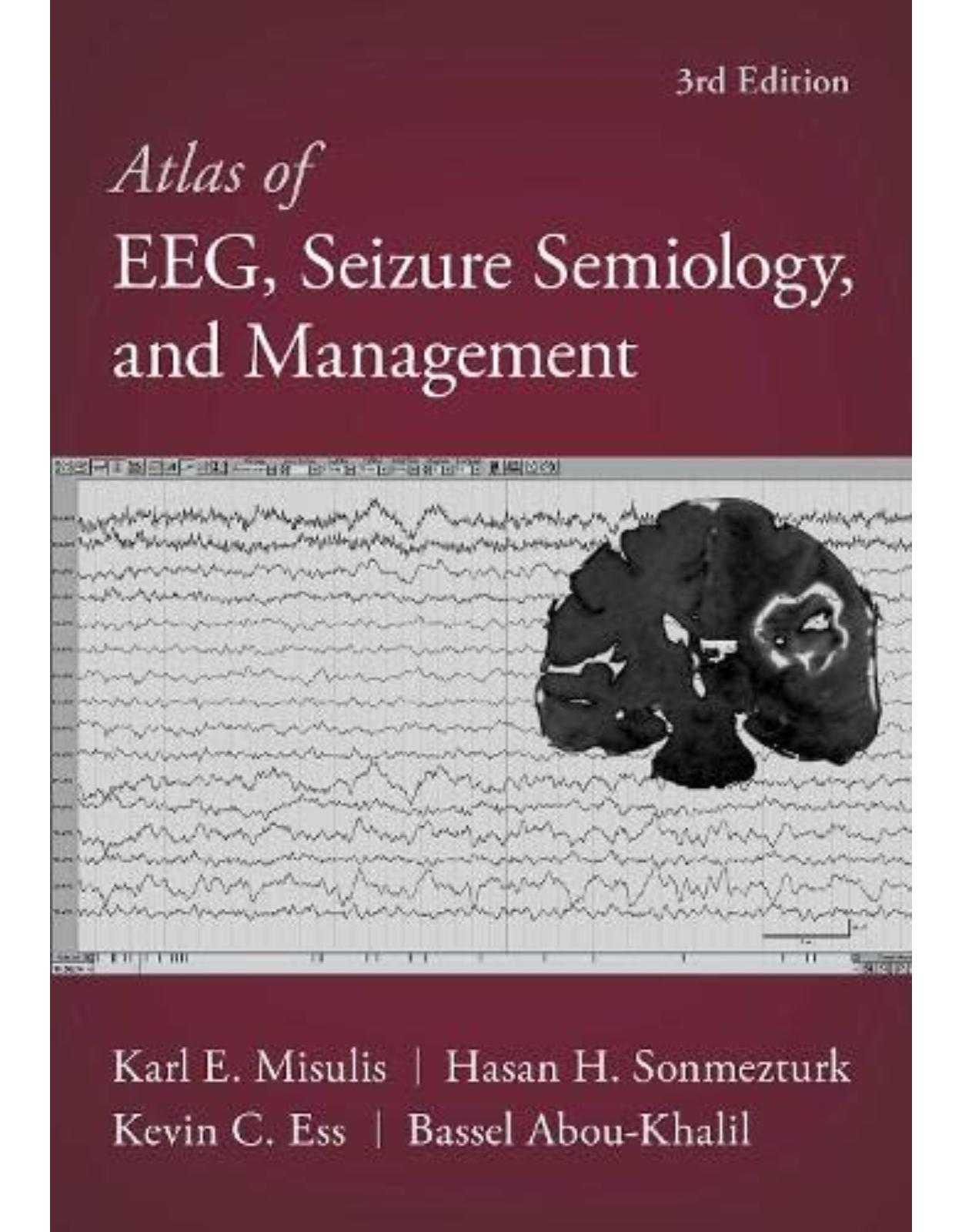 Atlas of EEG, Seizure Semiology, and Management 