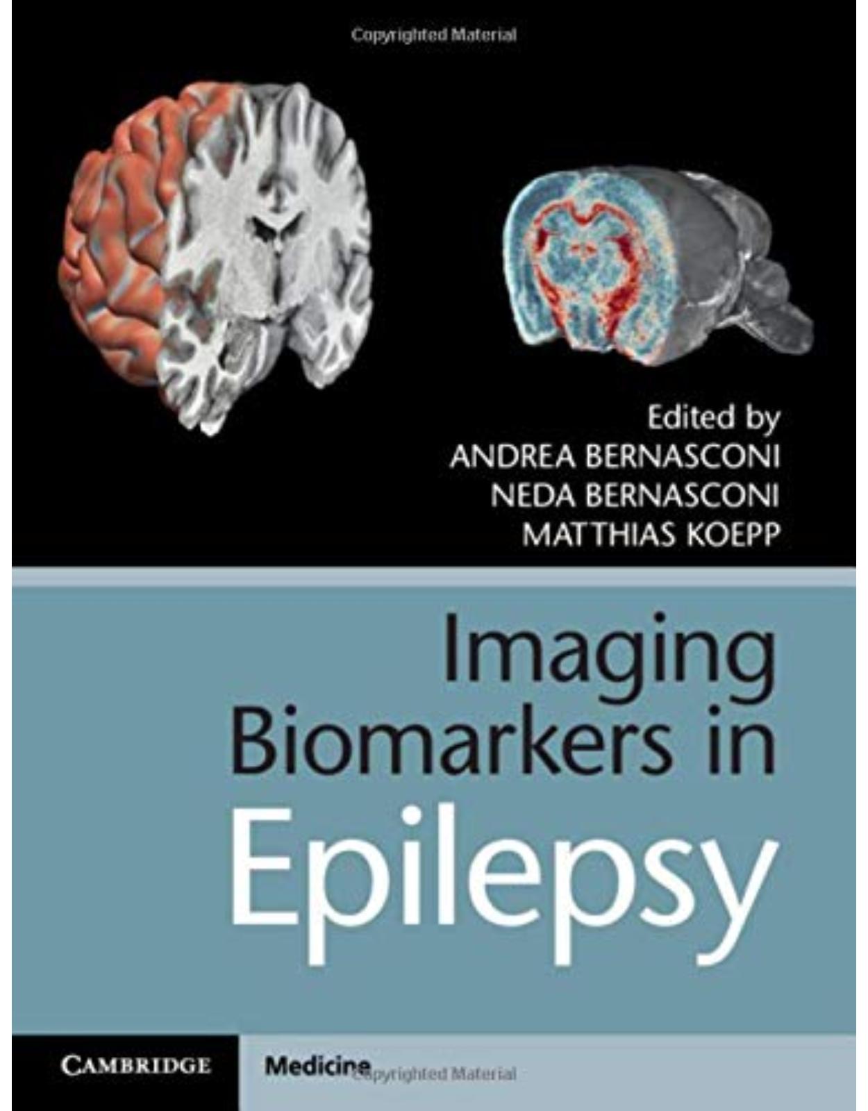 Imaging Biomarkers in Epilepsy