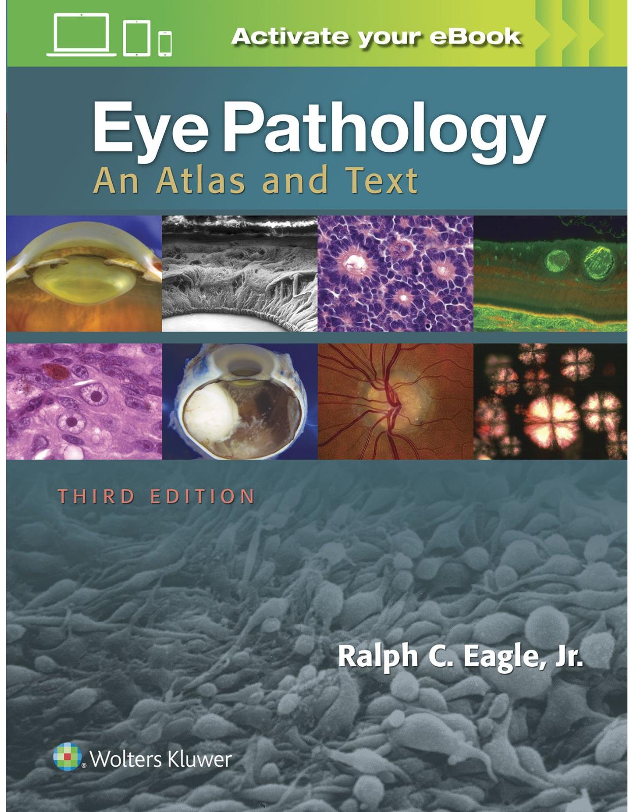 Eye Pathology: An Atlas and Text