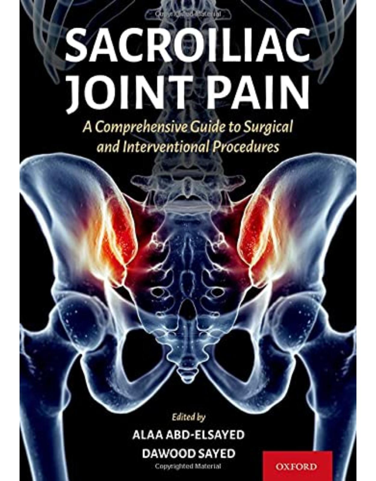 Sacroiliac Joint Pain: A Comprehensive Guide to Interventional and Surgical Procedures 