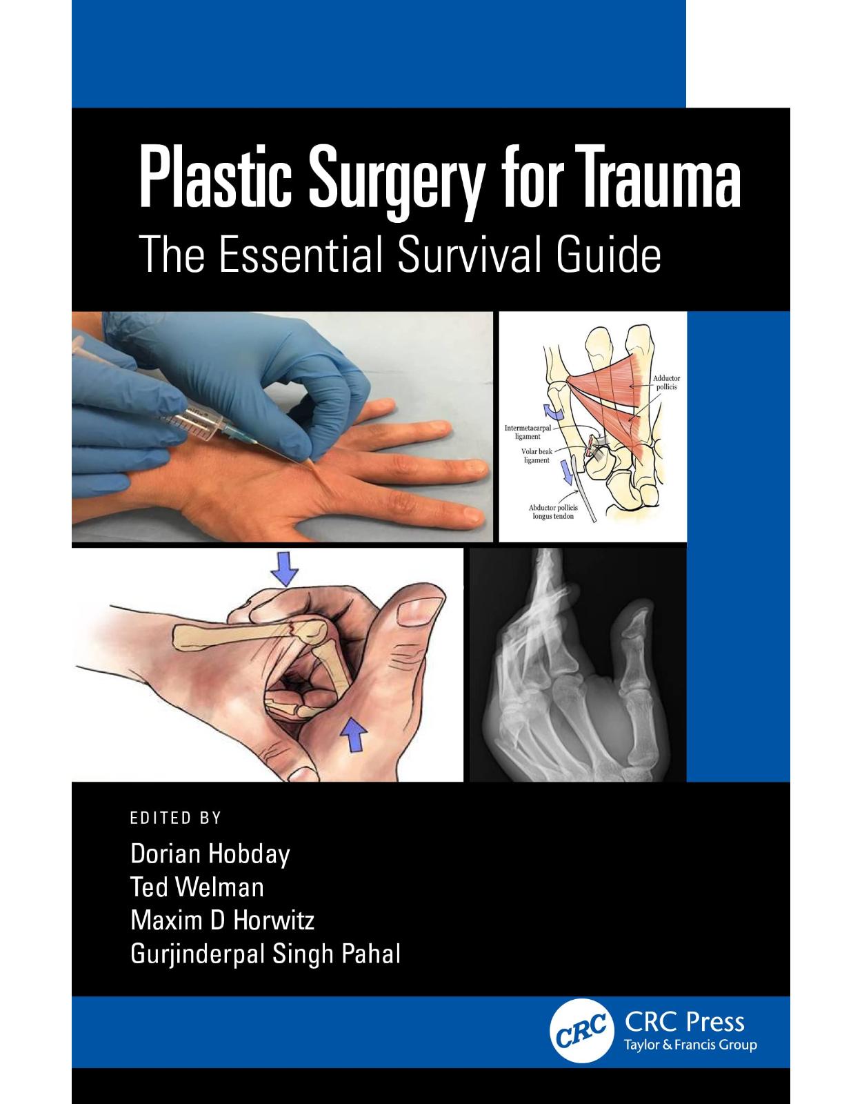 Plastic Surgery for Trauma: The Essential Survival Guide