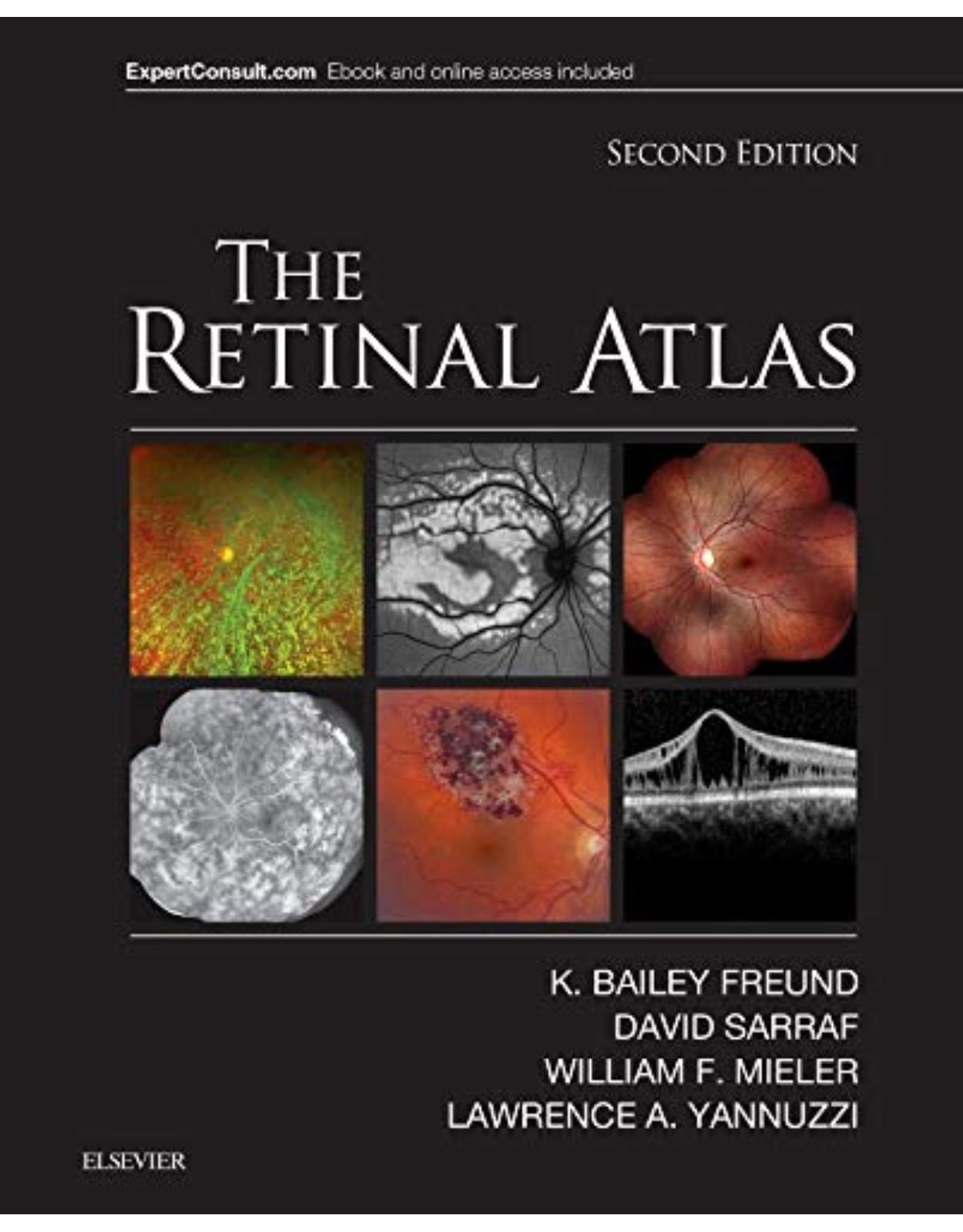 The Retinal Atlas, 2nd Edition 