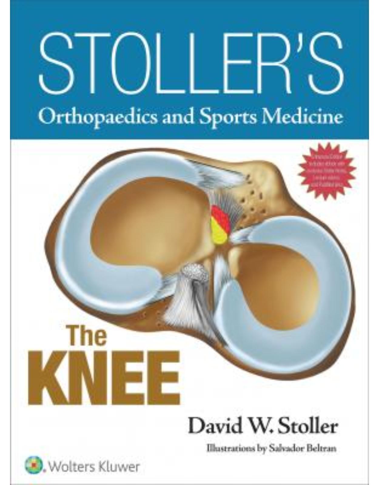 Stoller's Orthopaedics and Sports Medicine: The Knee