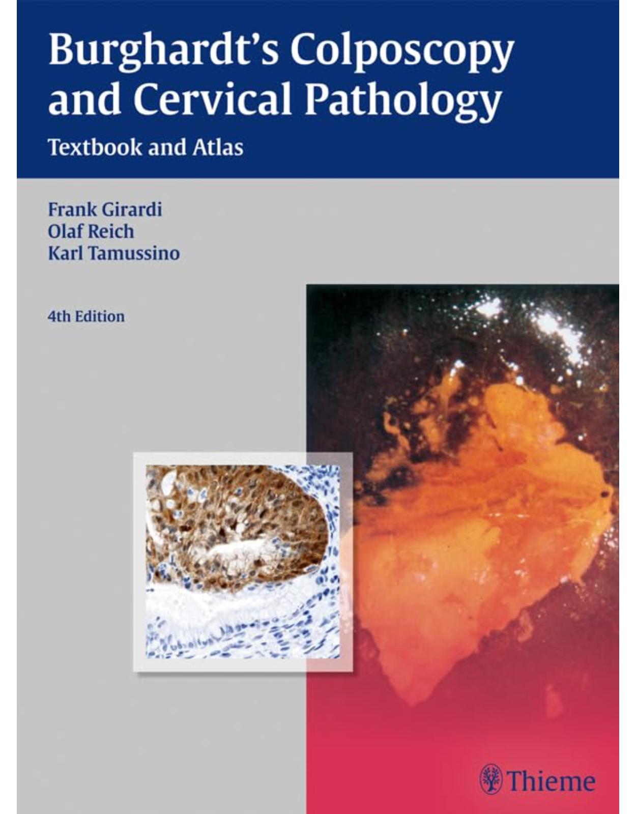 Burghardt�s Colposcopy and Cervical Pathology: Textbook and Atlas 4th edition 