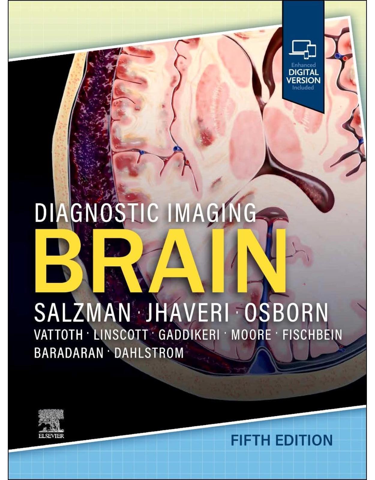 Diagnostic Imaging: Brain, 5th Edition