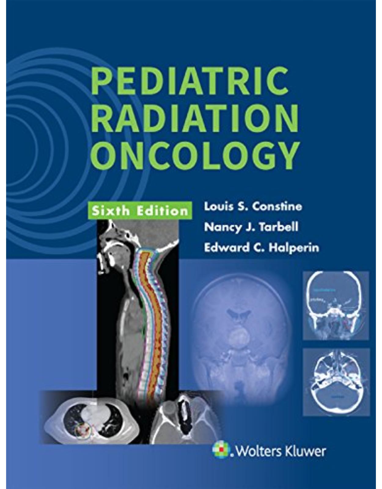 Pediatric Radiation Oncology, 6e 