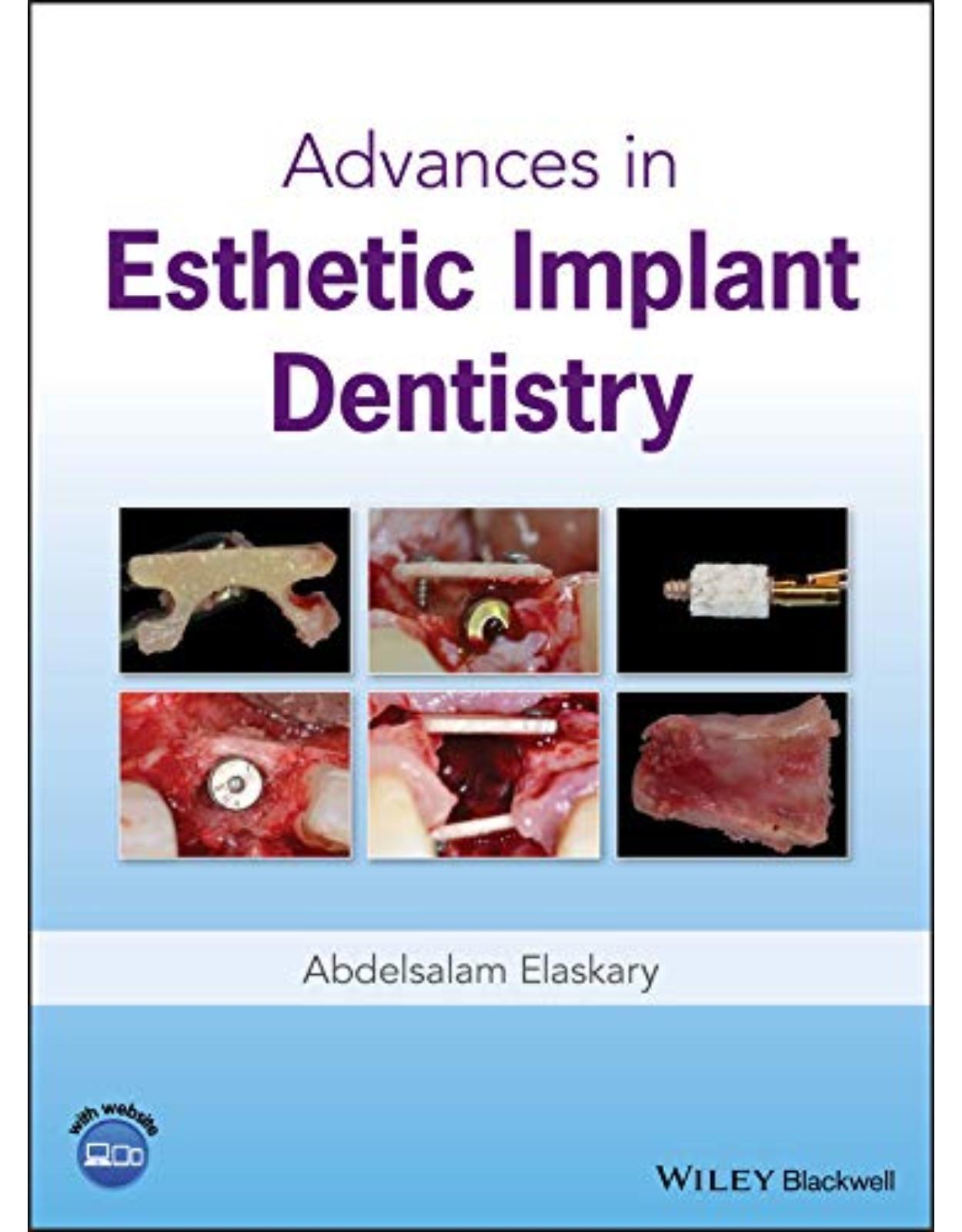 Advances in Esthetic Implant Dentistry