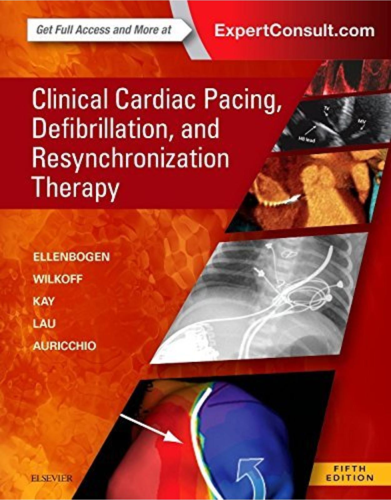 Clinical Cardiac Pacing, Defibrillation and Resynchronization Therapy, 5e