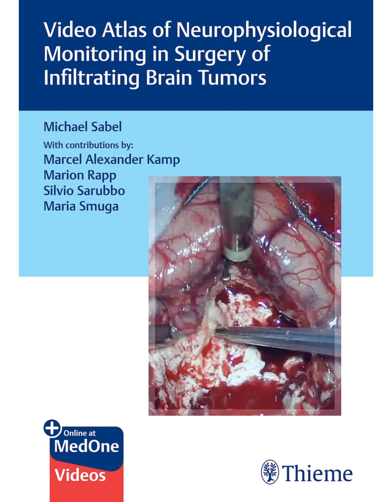 Video Atlas of Neurophysiological Monitoring in Surgery of Infiltrating Brain Tumors