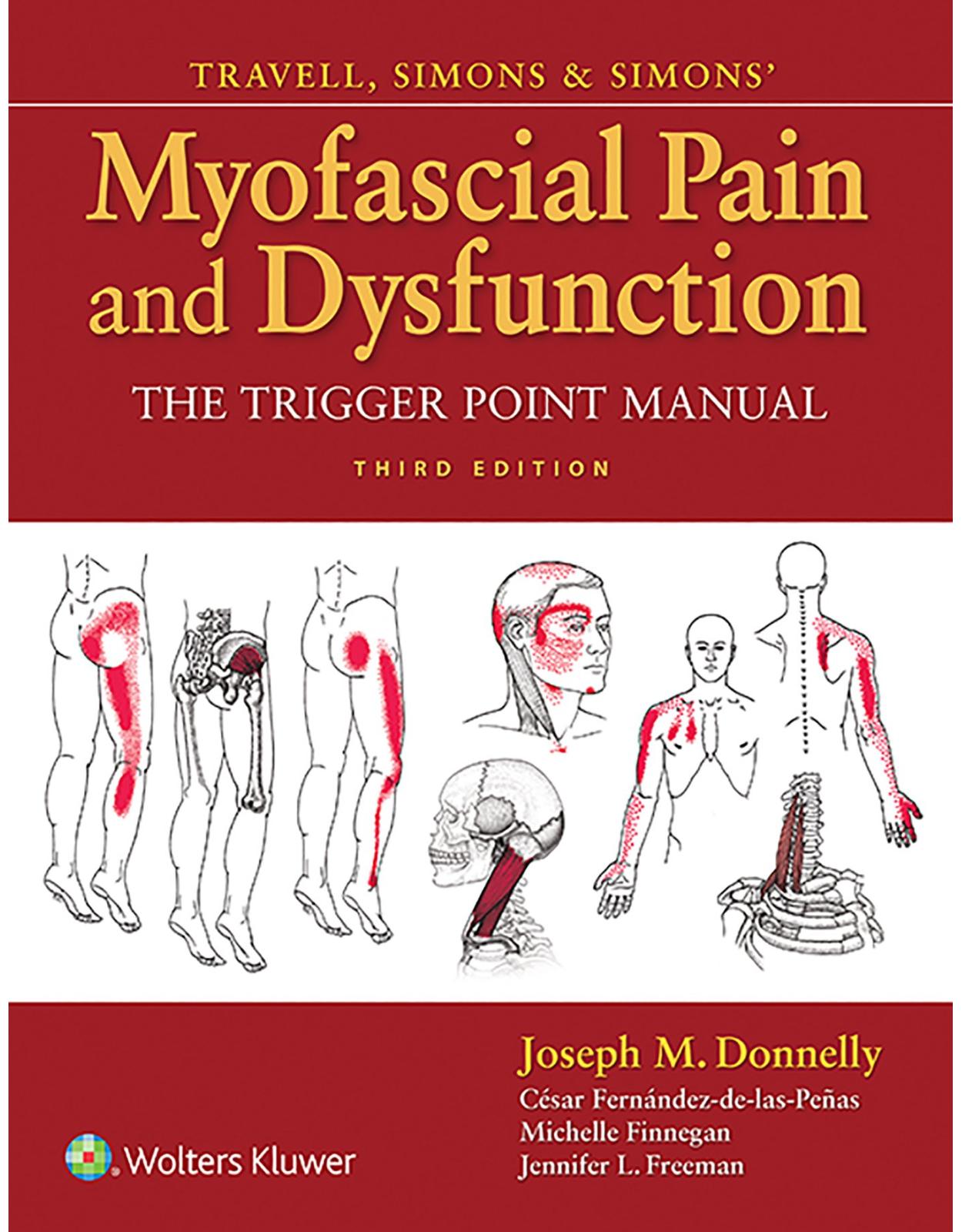 Travell and Simons' Myofascial Pain and Dysfunction: The Trigger Point Manual