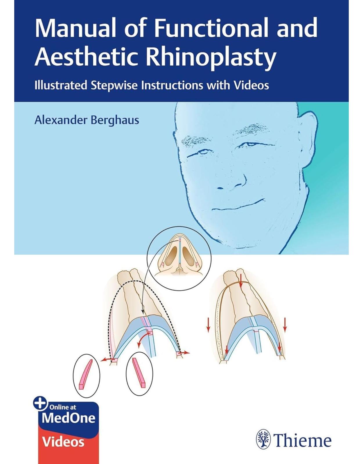 Manual of Functional and Aesthetic Rhinoplasty. Illustrated Stepwise Instructions with Videos