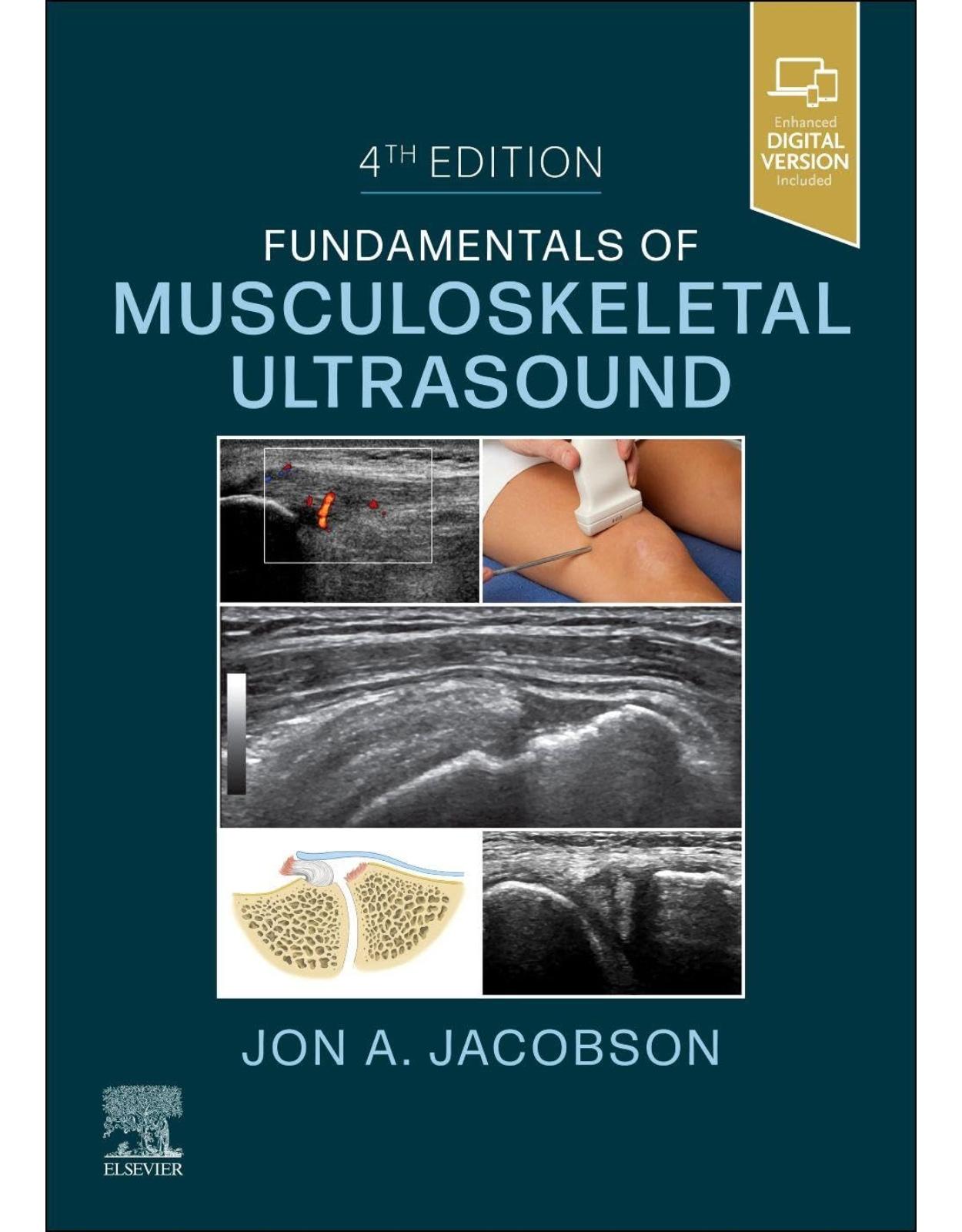 Fundamentals of Musculoskeletal Ultrasound, 4th Edition