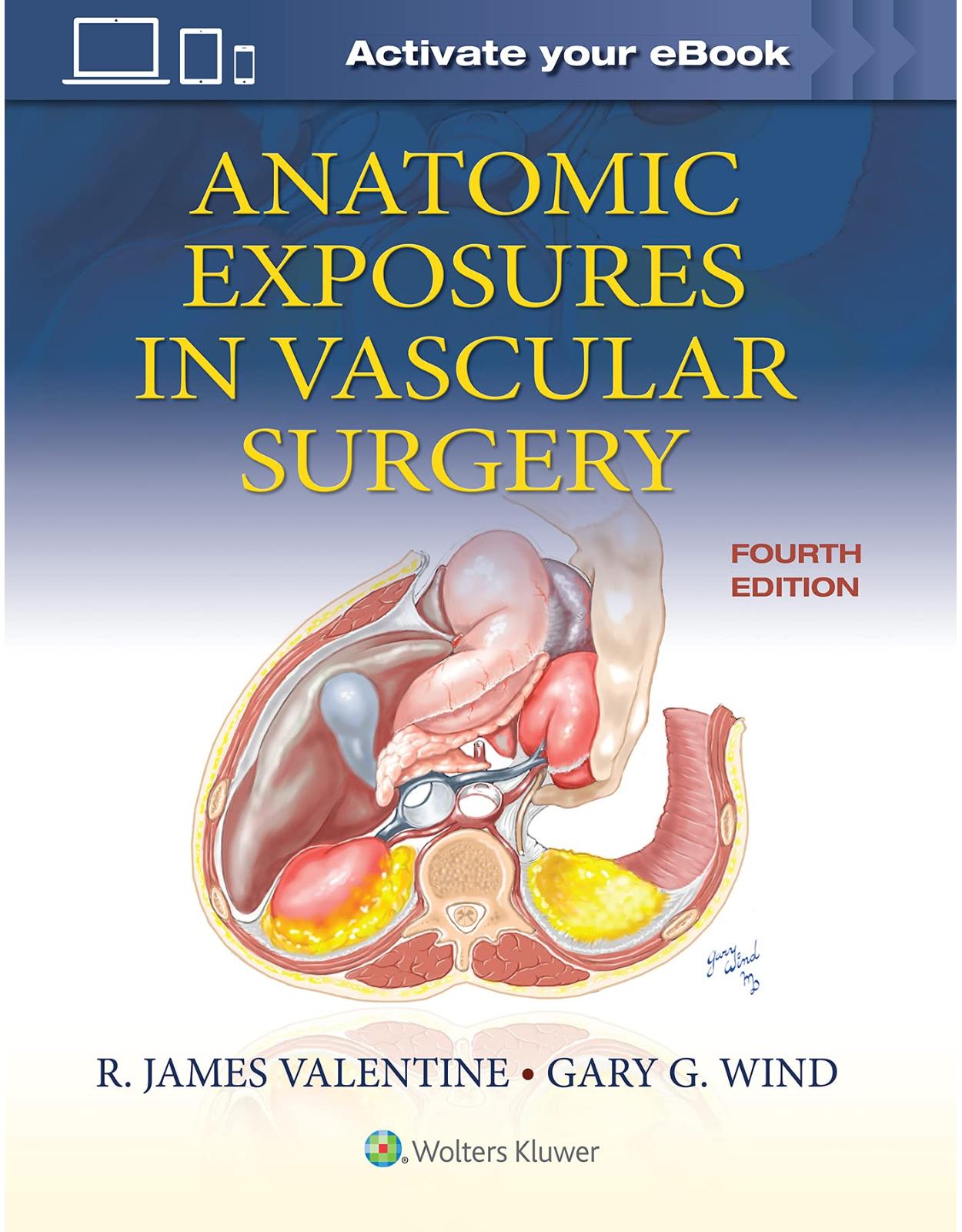 Anatomic Exposures in Vascular Surgery