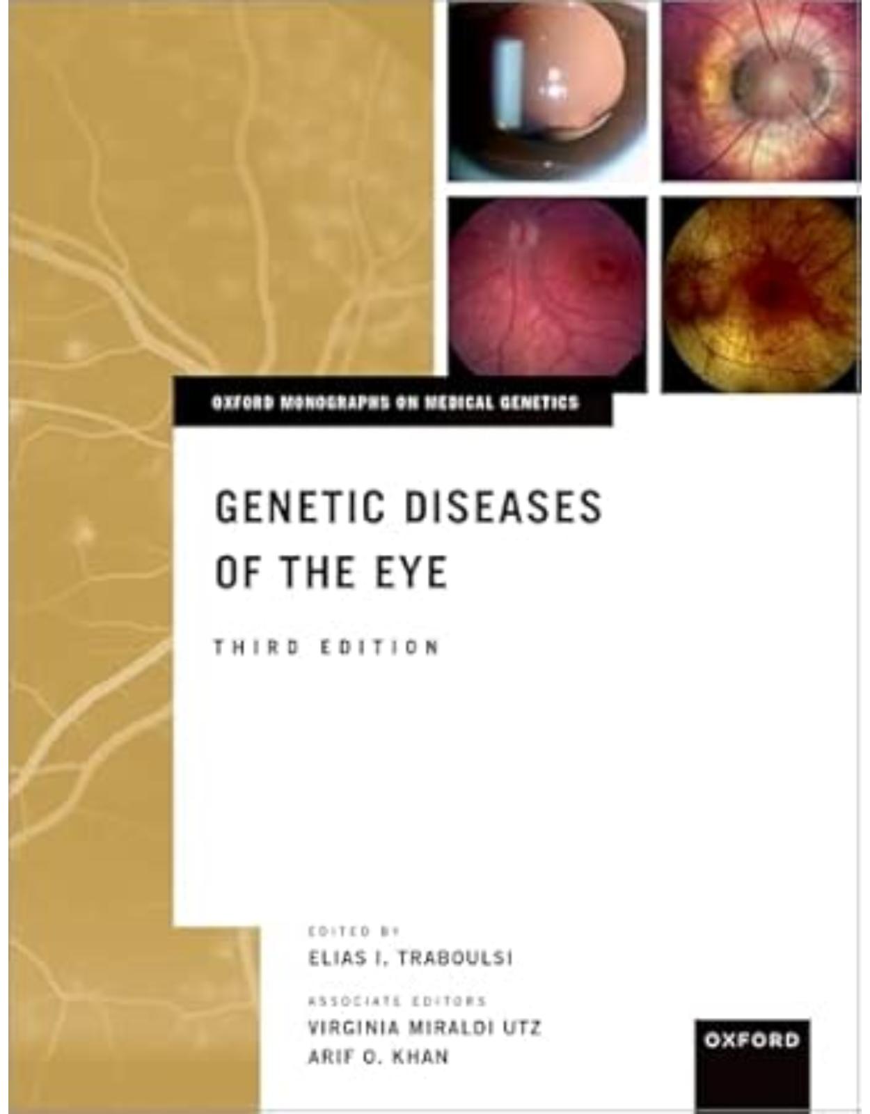 Genetic Diseases of the Eye. Third Edition
