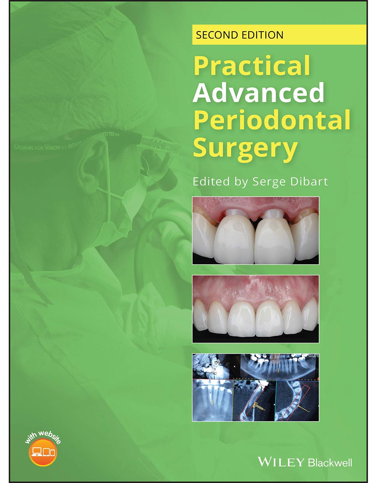 Practical Advanced Periodontal Surgery