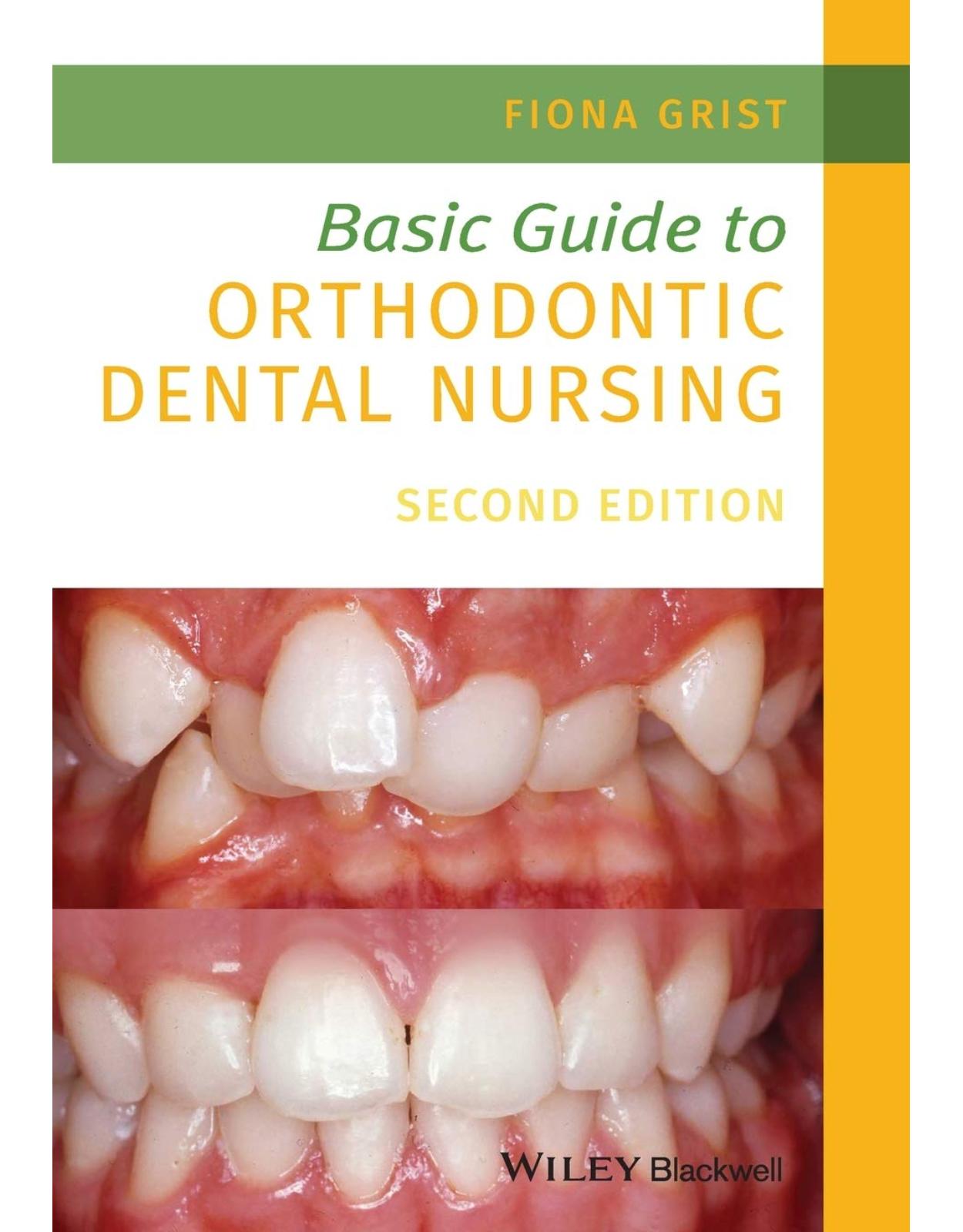 Basic Guide to Orthodontic Dental Nursing 2nd Edition