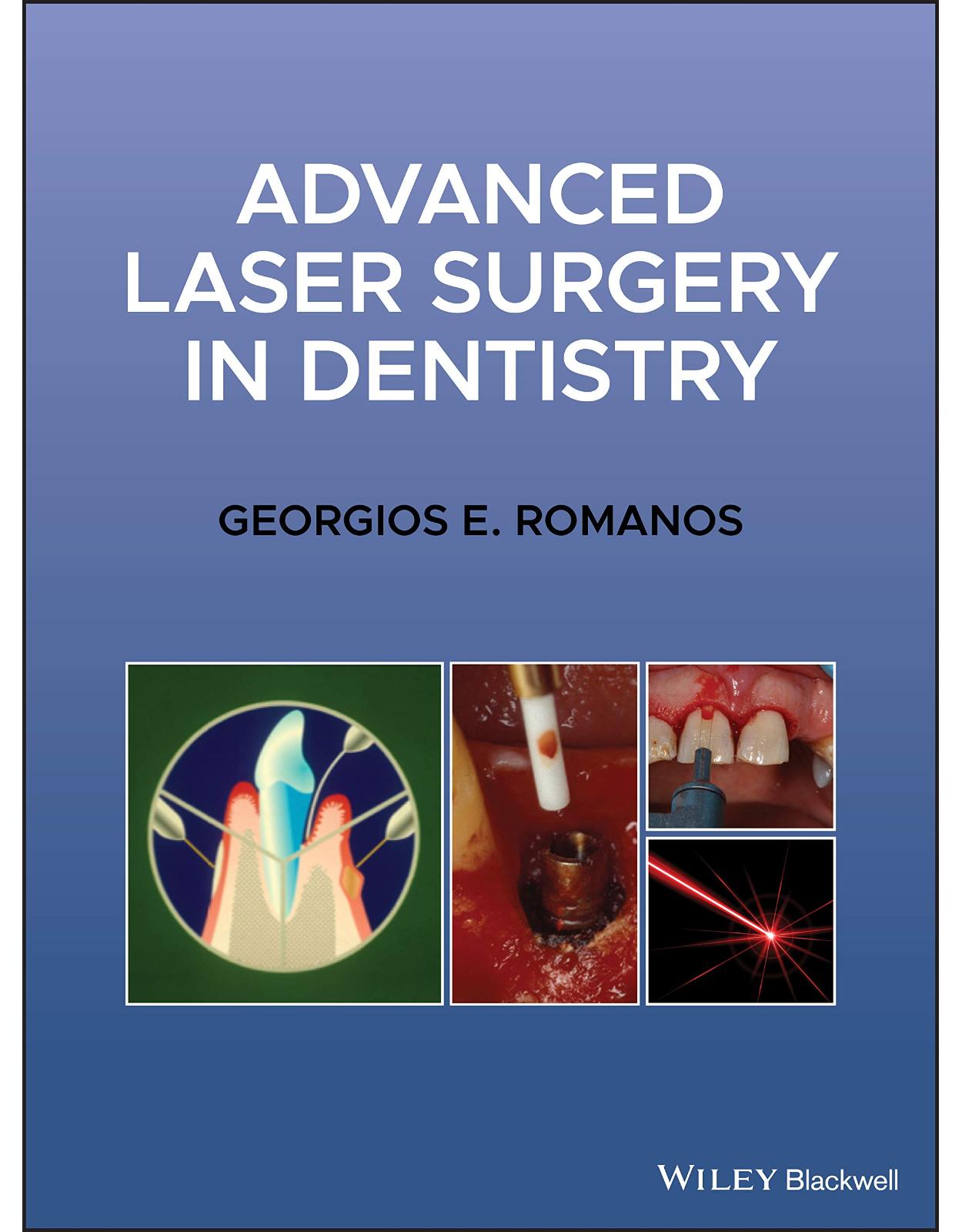 Advanced Laser Surgery in Dentistry