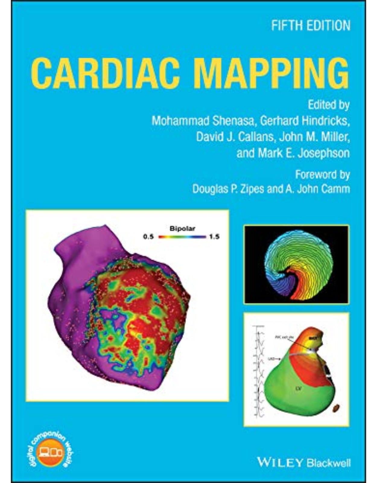 Cardiac Mapping