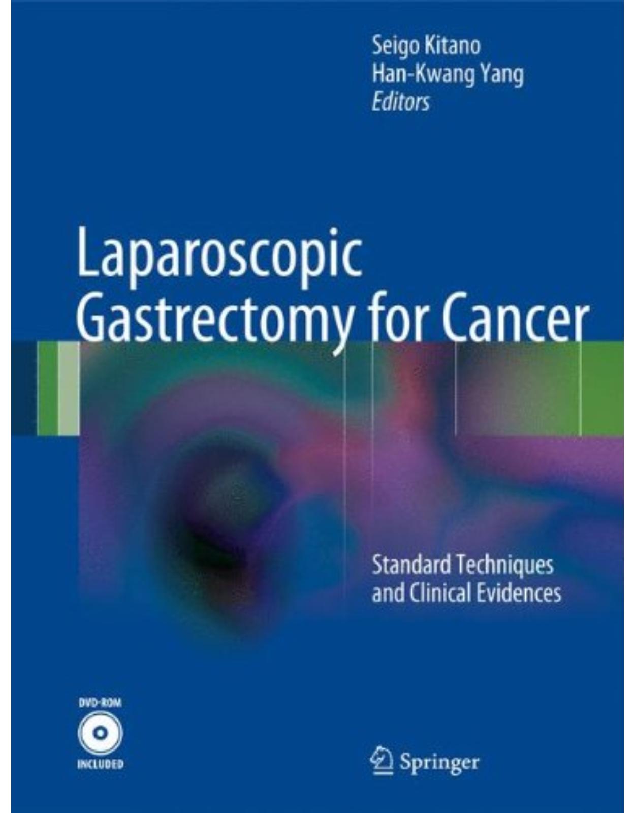 Laparoscopic Gastrectomy for Cancer