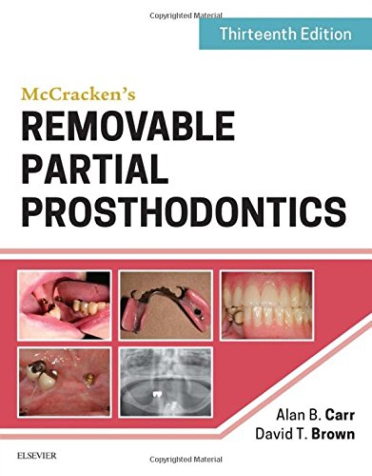 McCrackens Removable Partial Prosthodontics , 13th Edition