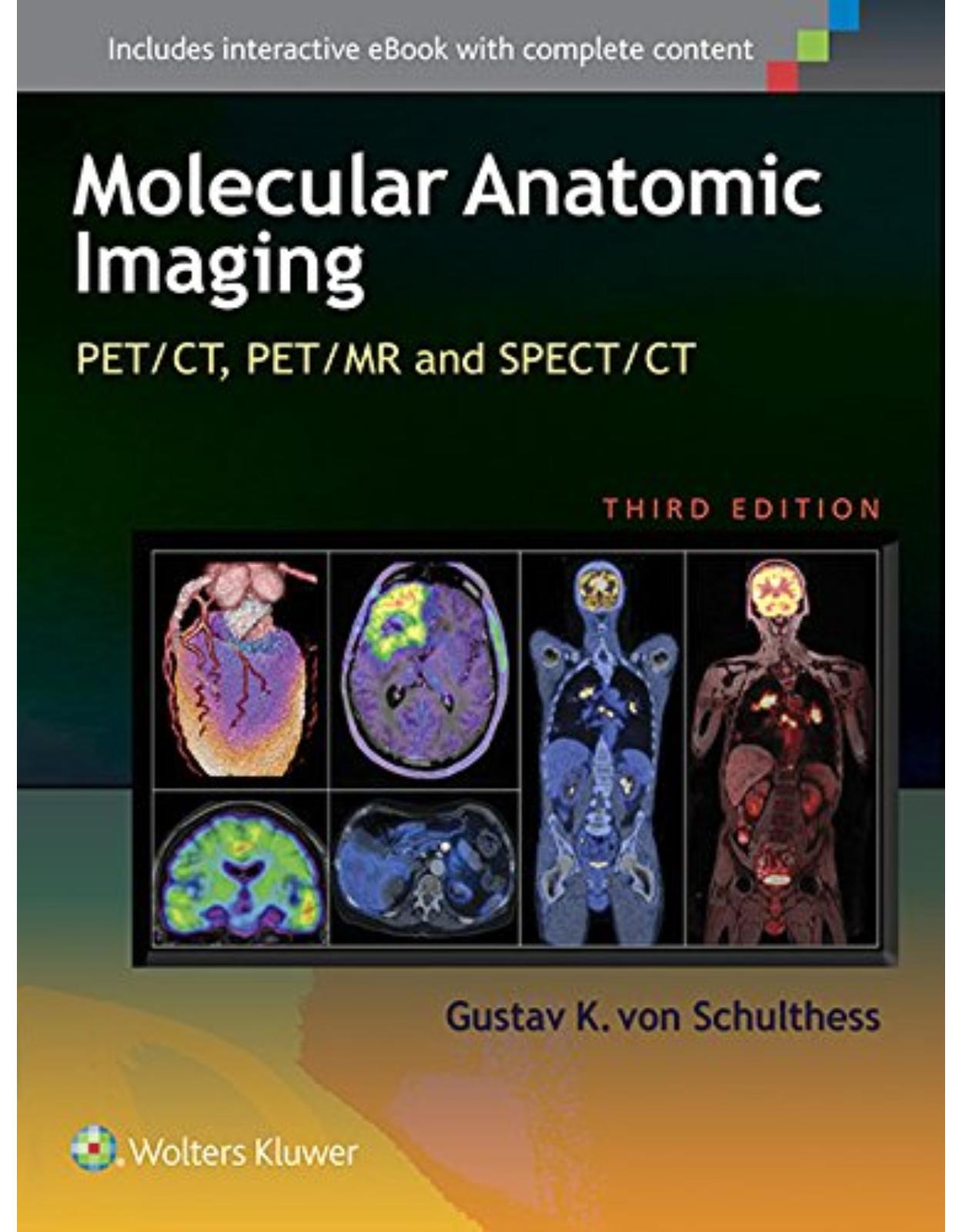 Molecular Anatomic Imaging: PET/CT, PET/MR and SPECT CT